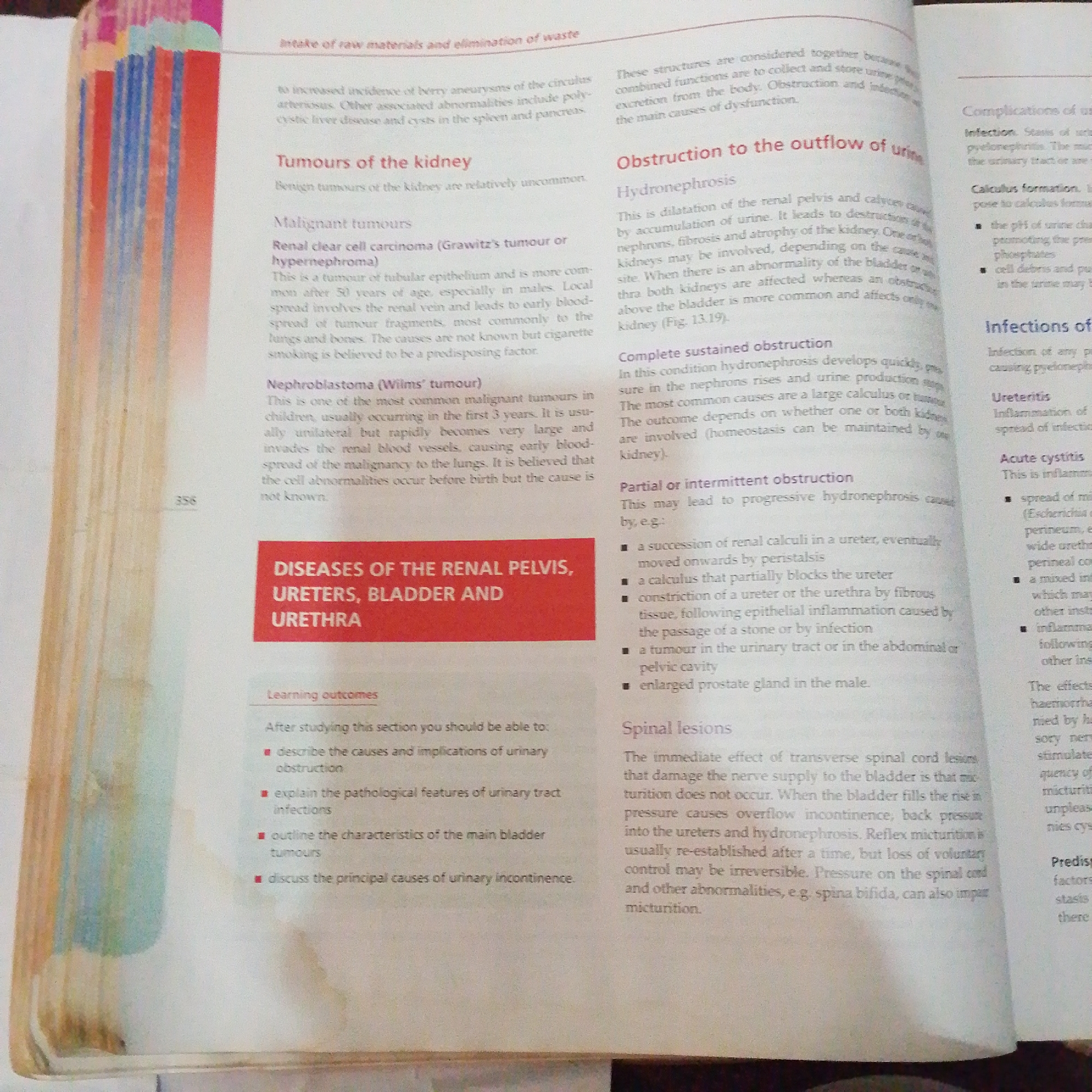 The image shows a page from a medical textbook. The text discusses diseases of the kidney and urinary tract, including tumors, obstruction, and infections. There is no information about Jalingo, Nigeria in the image.
