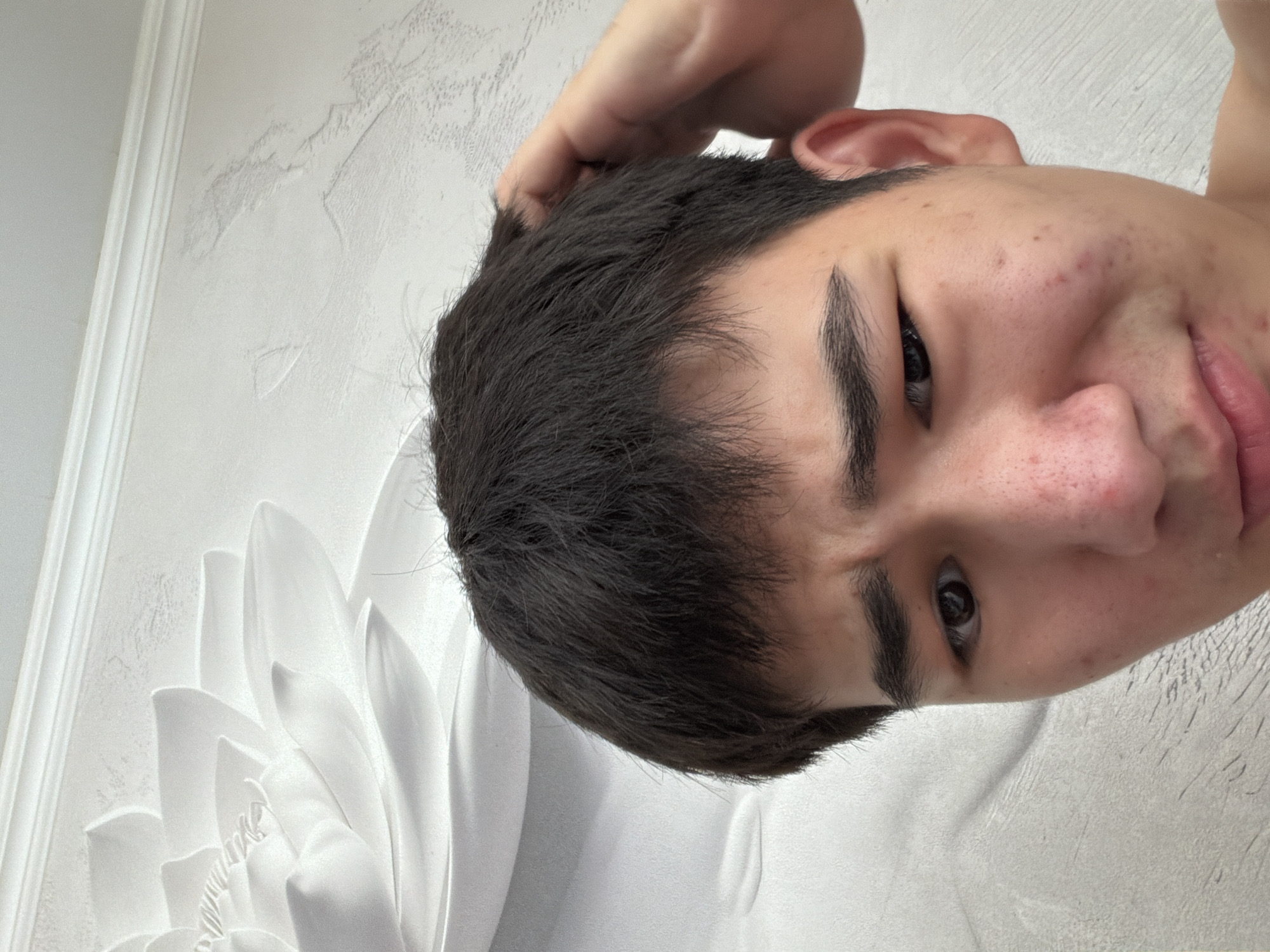 A close-up, head-and-shoulders shot shows a young East Asian male with dark hair, a light complexion, and visible acne on his face. He is looking upwards and to his left, with his right hand scratching the back of his head. His left eye appears slightly swollen. The background consists of a textured wall with a large, raised floral design. There is no discernible indication of the image's location in Shymkent, Kazakhstan.