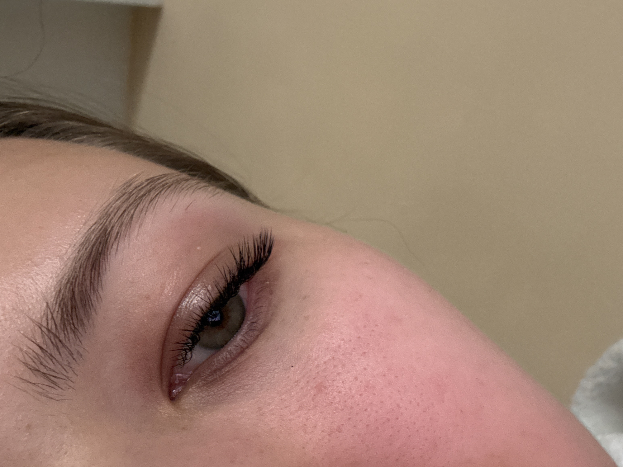 A close-up, high-angle shot captures the left side of a person's face, focusing on their eye, eyebrow, and cheek. The subject's left eye, with a greenish-brown iris, is open and looking slightly downwards and to the right. Long, dark, and voluminous eyelashes, possibly extensions or heavily mascaraed, frame the eye. The eyebrow above is well-defined with medium brown hairs.
The skin on the cheek and around the eye shows visible pores and a natural complexion with some subtle redness. A few small moles or freckles are present on the cheek area. The lighting is soft and appears to be artificial, suggesting an indoor setting.
The background is a plain, light brownish-beige surface, likely a wall. A small portion of a white, fluffy object, possibly a towel or blanket, is visible in the bottom right corner of the original image, suggesting a comfortable or treatment-related environment. No text is visible in the image. The image captures a static moment, possibly showcasing a beauty treatment outcome or a portrait detail. No specific location cues for Bečići, Montenegro are visible within the image itself.