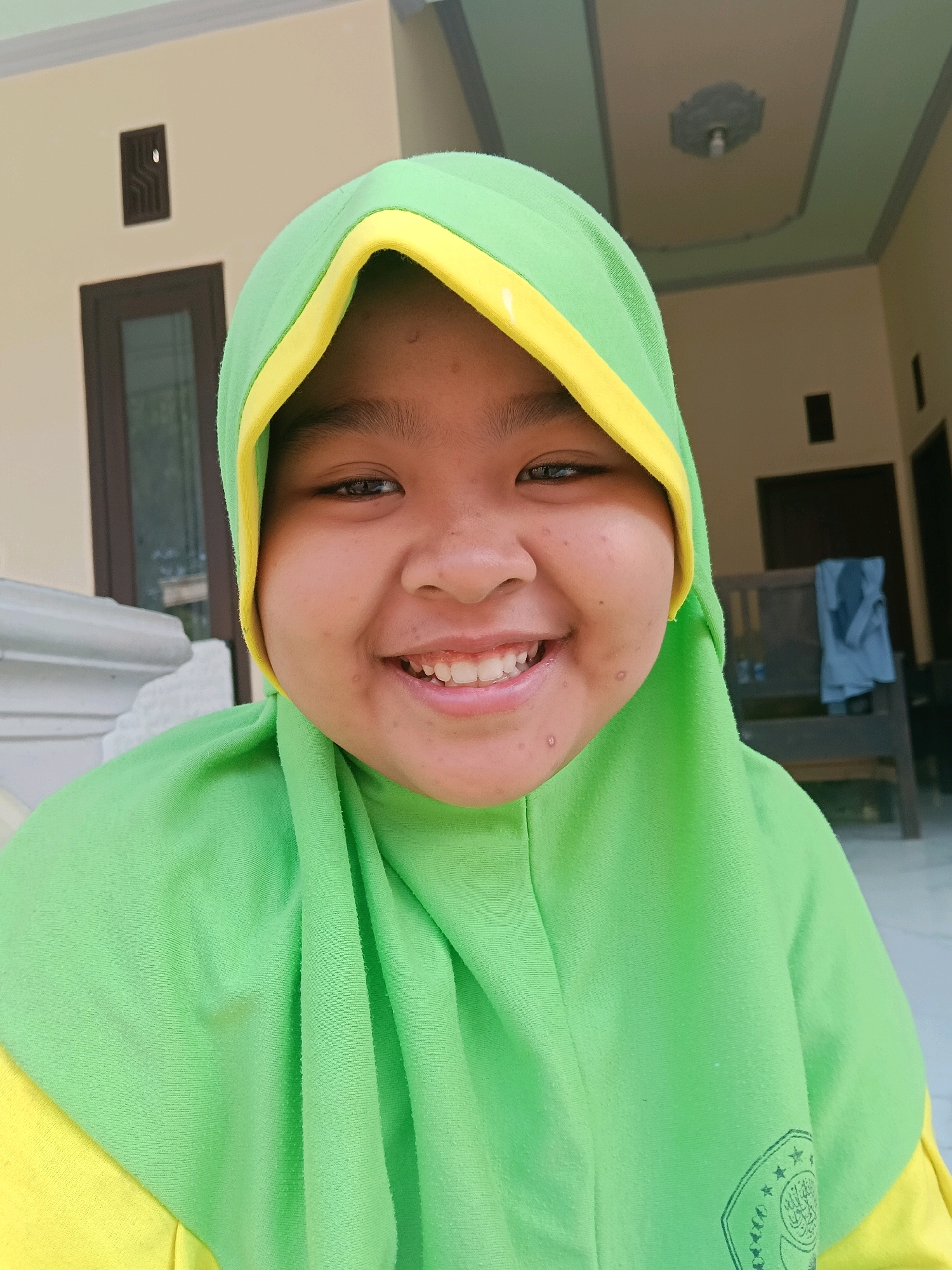 A close-up, portrait-style photograph captures a young girl wearing a bright green hijab with a yellow trim. She has a warm, wide smile, revealing her teeth. Her skin appears to have a few small marks or blemishes. She is looking directly at the camera. The background is slightly out of focus, showing a building with cream-colored walls and dark brown window frames. There is also a glimpse of outdoor furniture, possibly a bench, and a ceiling with a light fixture. The overall lighting suggests it is daytime.