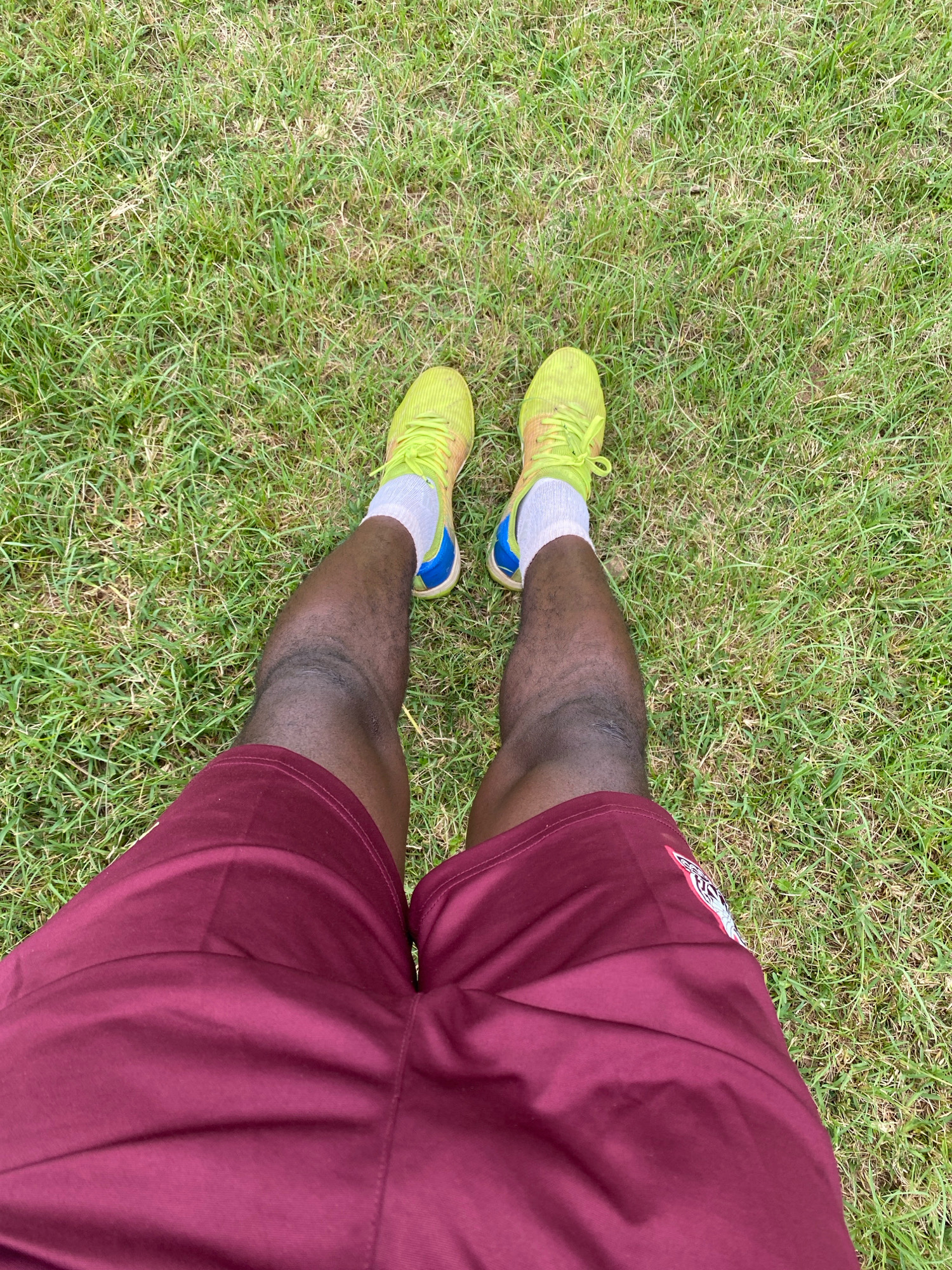 A high-angle, full-body shot captures a person standing on a grassy field. The individual is wearing bright yellow athletic shoes with white socks, burgundy shorts, and has dark skin. The shoes have blue accents. The legs show visible muscle definition, with some darkening around the knees. The grass is green and appears to be short and well-maintained, suggesting it could be a sports field or park. The lighting indicates it is daytime, likely outdoors, with no discernible urban elements or specific landmarks to pinpoint the exact location within Jos, Nigeria.