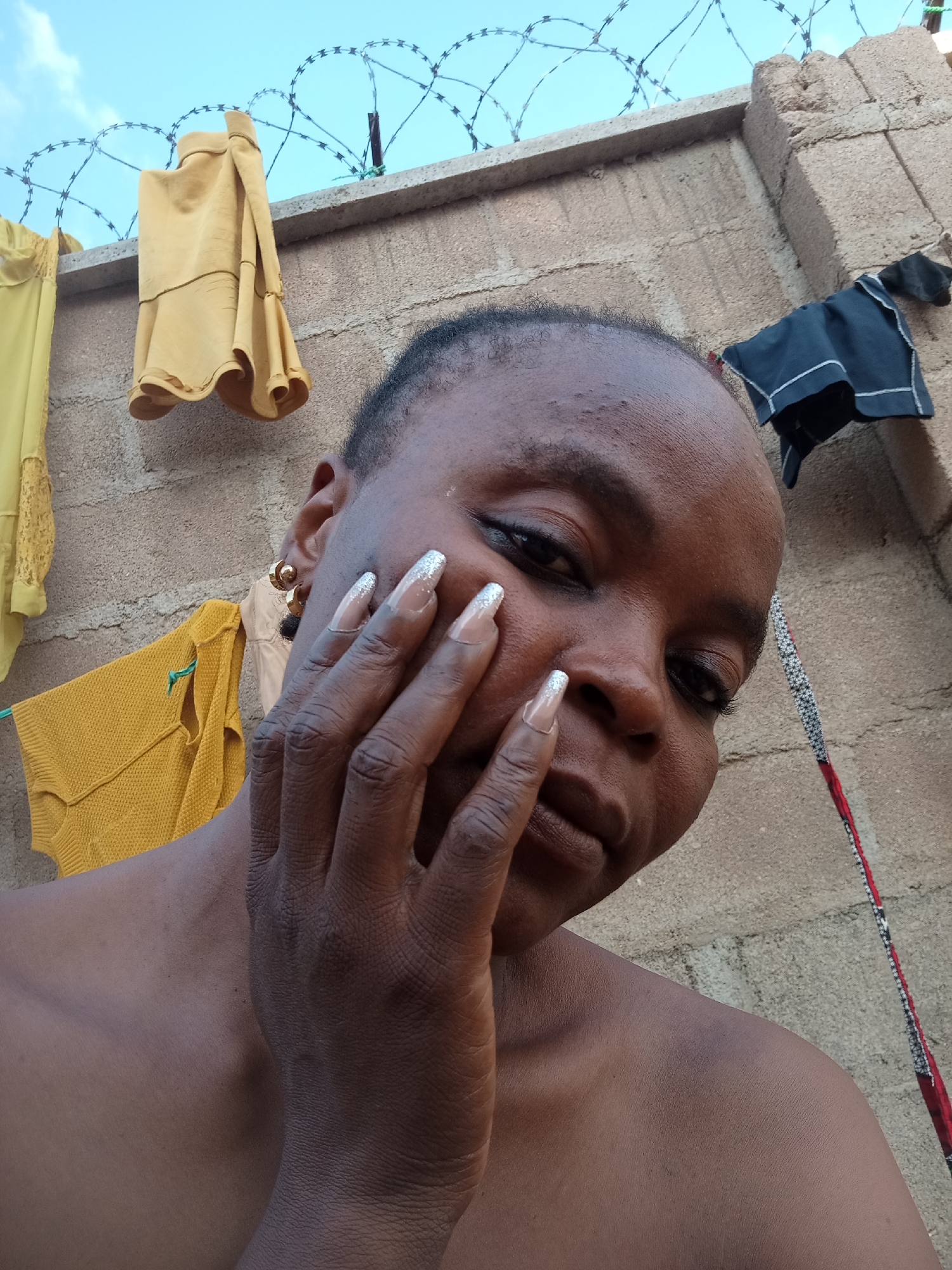 In Kason, Nigeria, a close-up, low-angle outdoor photograph captures a dark-skinned person posing against a concrete wall. The individual is wearing sparkly, long fingernails and a golden hoop earring. Yellow and black garments are draped over a barbed-wire fence in the background, suggesting a laundry line. The person's hand is resting on their face, and their skin appears to have a purplish bruise on their shoulder. The sky above is a pale blue, with wisps of clouds.