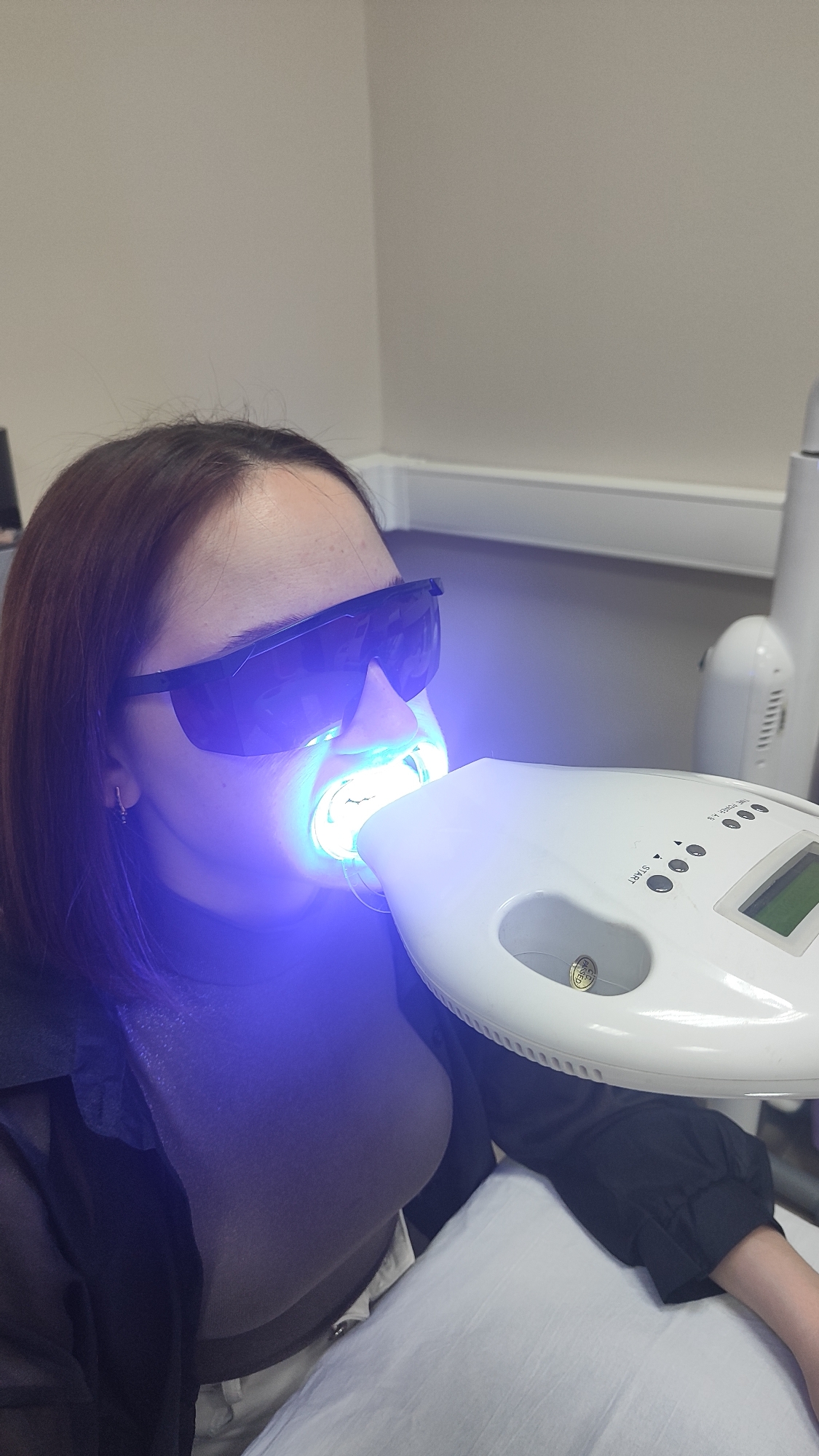 A woman with auburn hair is undergoing a teeth whitening procedure. She is wearing protective eyewear and is positioned beneath a blue light emitting whitening device. The scene is likely taking place in a dental office. The location in the city of Chaikovsky, Russia, cannot be determined from the image.