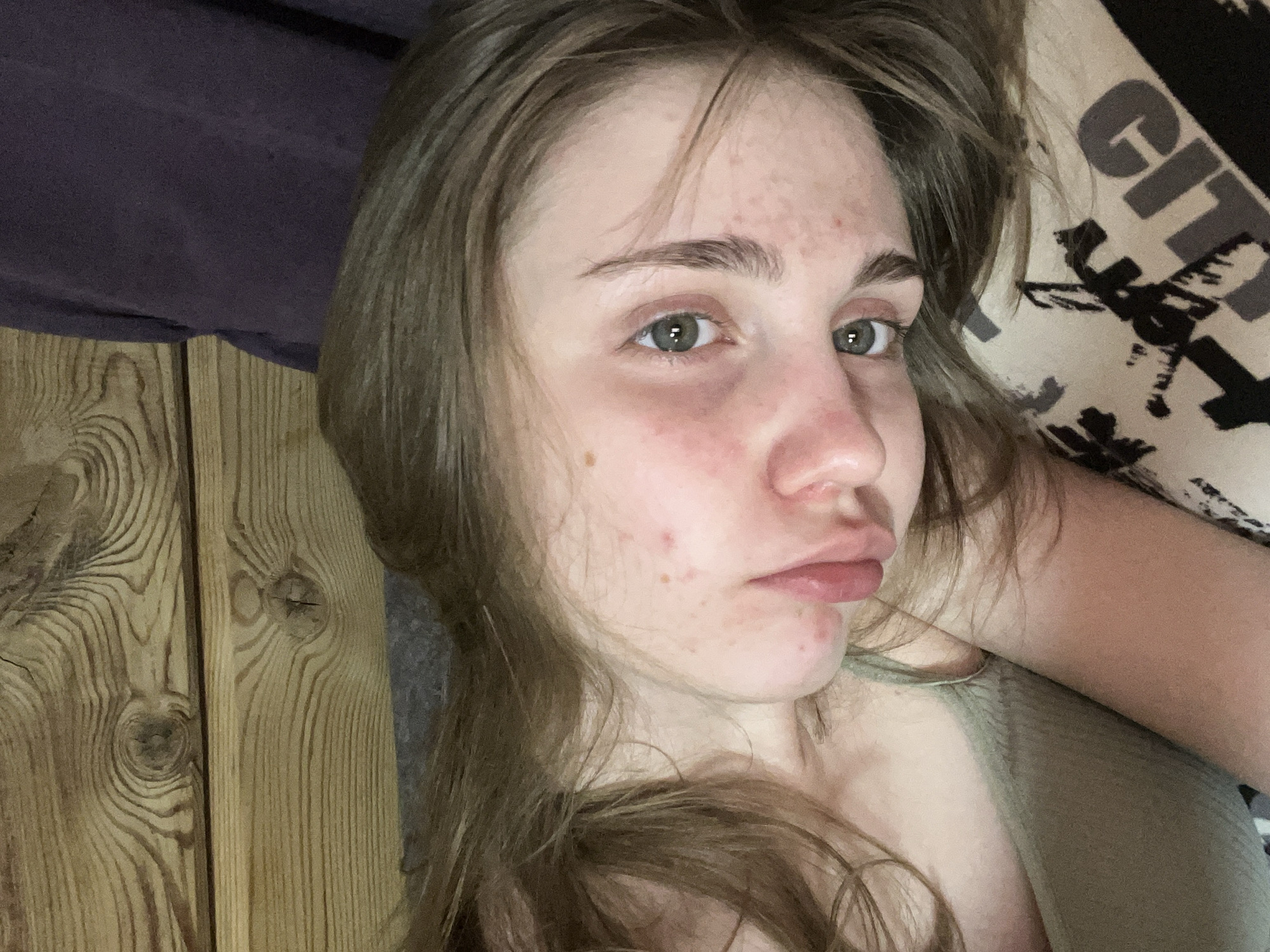 A close-up, tilted shot shows a young person with long, brown hair lying on their side. Their face is angled towards the camera, revealing green eyes with dark pupils. The individual has fair skin with some redness on their cheeks and scattered blemishes. Their lips are slightly parted, with one side of their mouth slightly open. They are wearing a light green, ribbed tank top. The background consists of wooden planks, some with prominent knots, and a dark purple fabric. A patterned fabric is visible beneath the person's head. The lighting is dim, suggesting an indoor setting. There is no indication of the city of Ashkadar, Russia, or any specific urban environment in this image.