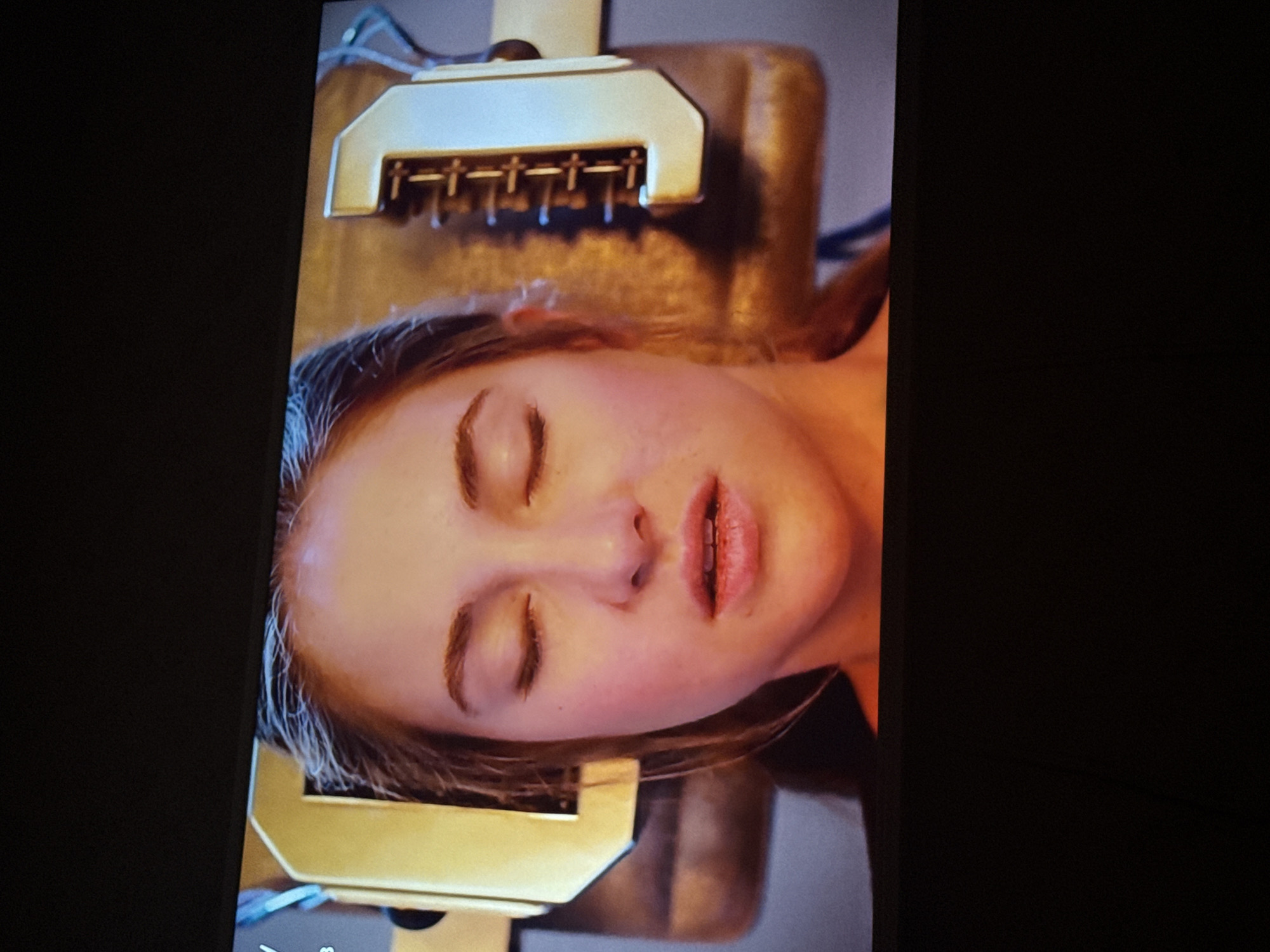 A woman lies with her eyes closed, her head held by a metallic device. The scene does not contain enough details to determine a location, including the city of Mytishchi, Russia.