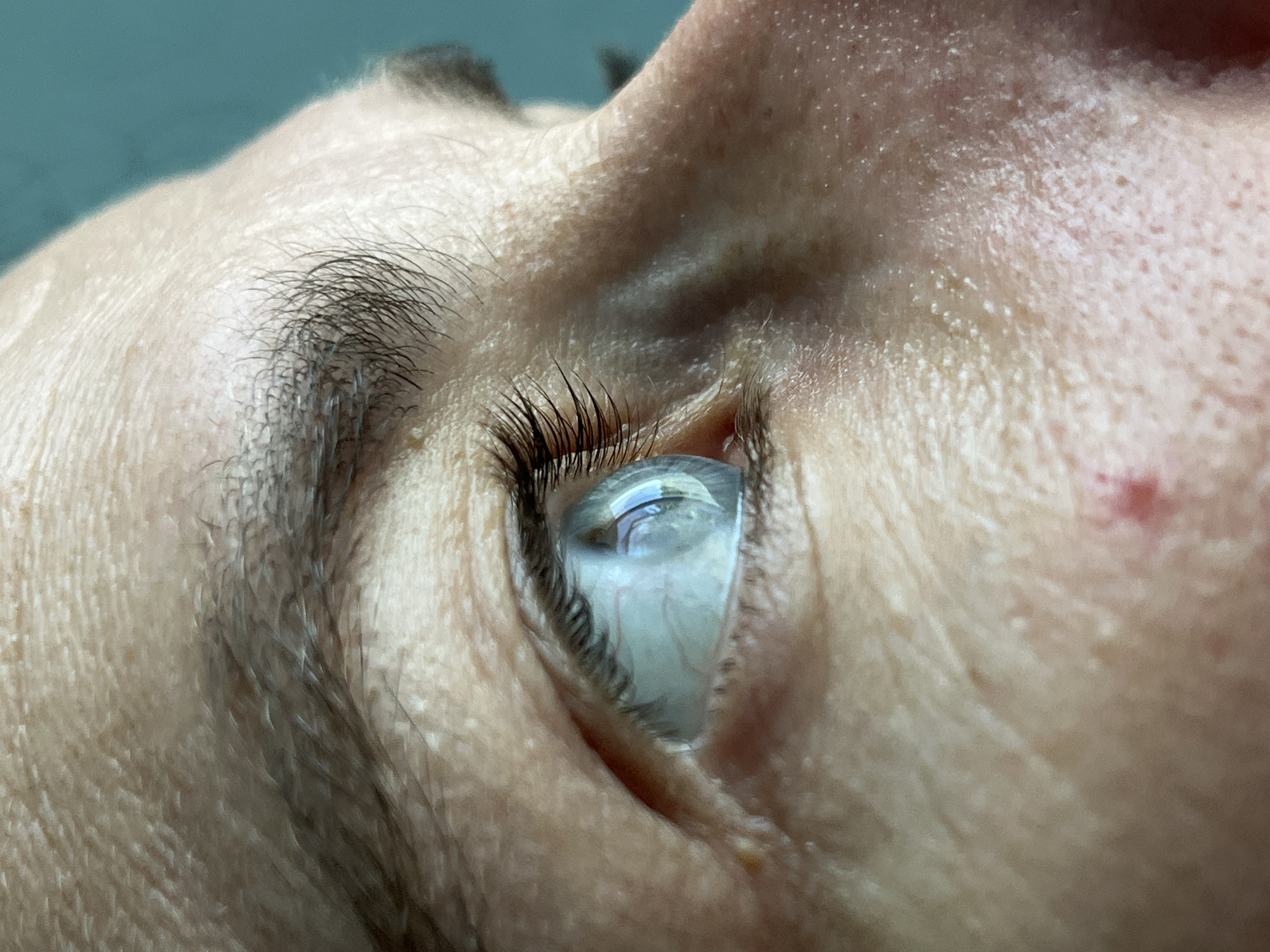 This is a close-up, profile view of a person's left eye, taken in what appears to be an indoor setting. The eye is open and looking towards the right of the frame, with the iris and pupil clearly visible and reflecting light. Eyelashes are long and dark. The skin around the eye shows texture, including pores and fine lines. A small red blemish is visible on the cheekbone area below the eye. The background is a solid teal color, suggesting an artificial or neutral environment. The image does not provide any specific contextual clues to determine its location within ღრმაღელის თემი, Georgia.