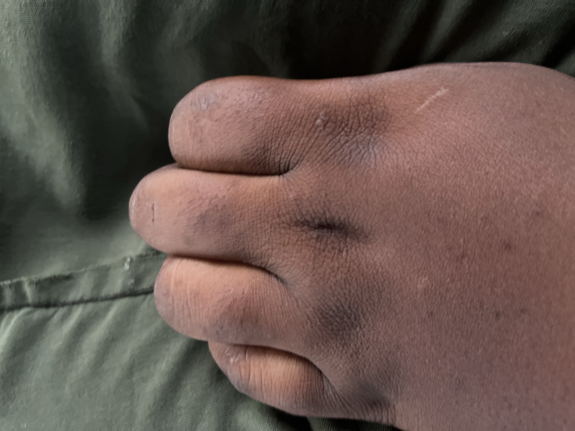 A close-up, overhead shot shows the toes of a person's foot resting on a green fabric surface. The skin is dark brown and shows some texture and dryness. The toes are curled slightly, and the toenails are not visible. The green fabric appears to be wrinkled and has a seam running vertically through the image on the left side. The lighting is even, and there are no distinct shadows. The overall scene is static and focuses on the detail of the foot and fabric. The location of Jalingo, Nigeria is not determinable from the visual information present in the image.