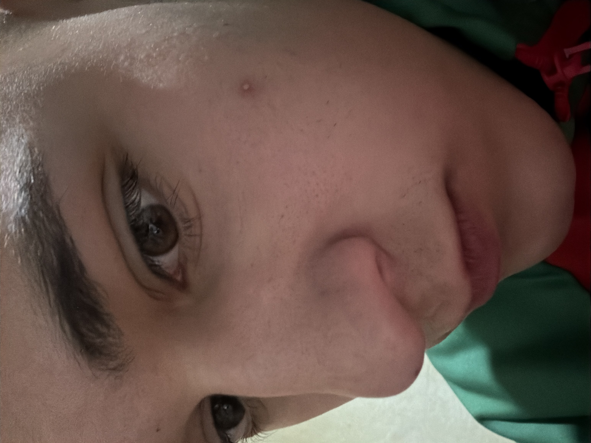 The image is a close-up shot of a person's face, rotated slightly counter-clockwise. The subject has light skin, dark eyes and eyebrows, and short facial hair above the lip. A pimple is visible on the cheek. The background includes green and red fabric, likely clothing. There is no information to indicate the city of Panagyurishte, Bulgaria.