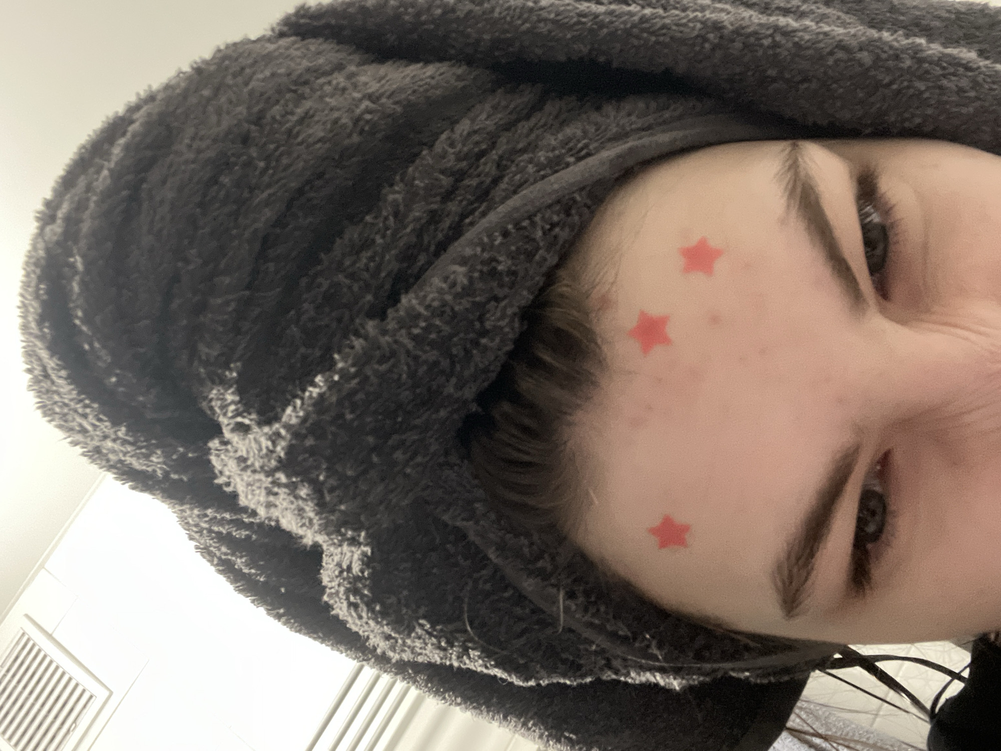 A close-up, angled shot shows a person's face and head covered by a gray towel. Three red star-shaped stickers are on their forehead, near their eyebrow. The person's eyes are visible, and their expression is partially obscured. The background is blurred, suggesting a bathroom setting with a ventilation grille visible. The image doesn't provide enough information to pinpoint a specific location in Saint Petersburg, Russia, or any other location.