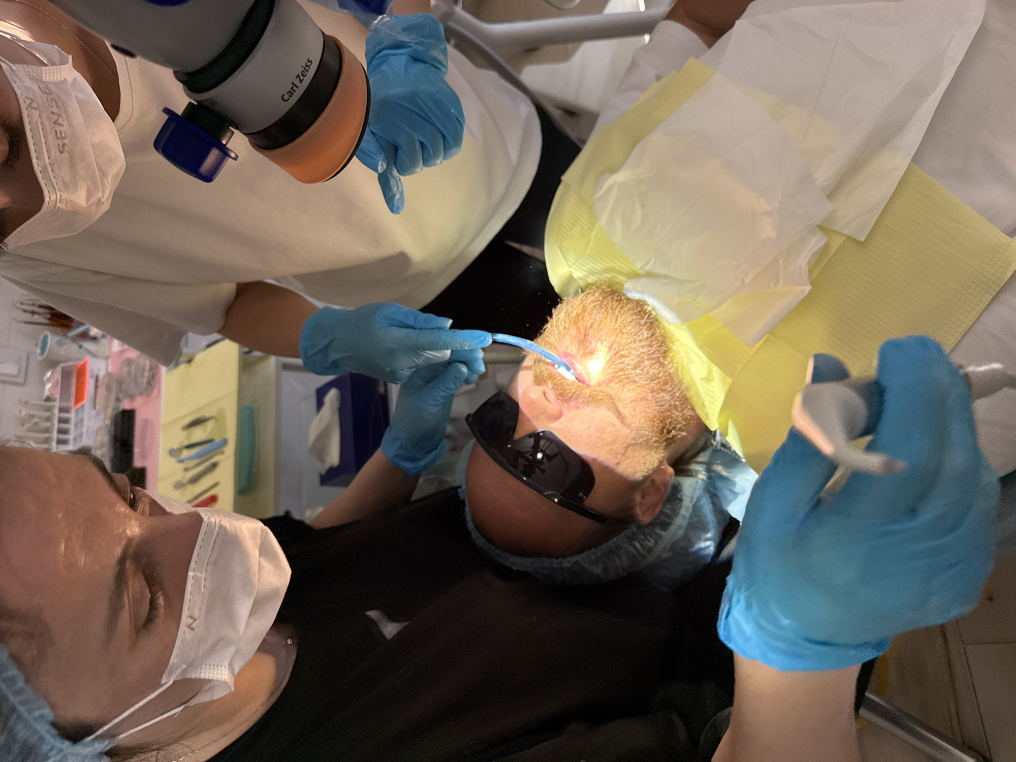 The image depicts a close-up, overhead view of a dental procedure taking place in a professional setting. A male patient, wearing dark protective eyewear and a blue surgical cap, reclines in a dental chair, his mouth open. He has reddish-brown facial hair. Two dental professionals, both wearing blue surgical gloves and face masks, are attending to the patient. One professional, on the left, appears to be using a dental instrument near the patient's mouth. The other professional, on the right, is operating a Carl Zeiss dental microscope, directing it towards the patient's oral cavity. The environment appears to be a dental clinic, with medical equipment and supplies visible in the background, including dental tools laid out on a surface and a blue box with tissues. The lighting is focused on the operative area, creating highlights and shadows. The scene is consistent with a dental treatment being performed, likely involving magnification for precision.