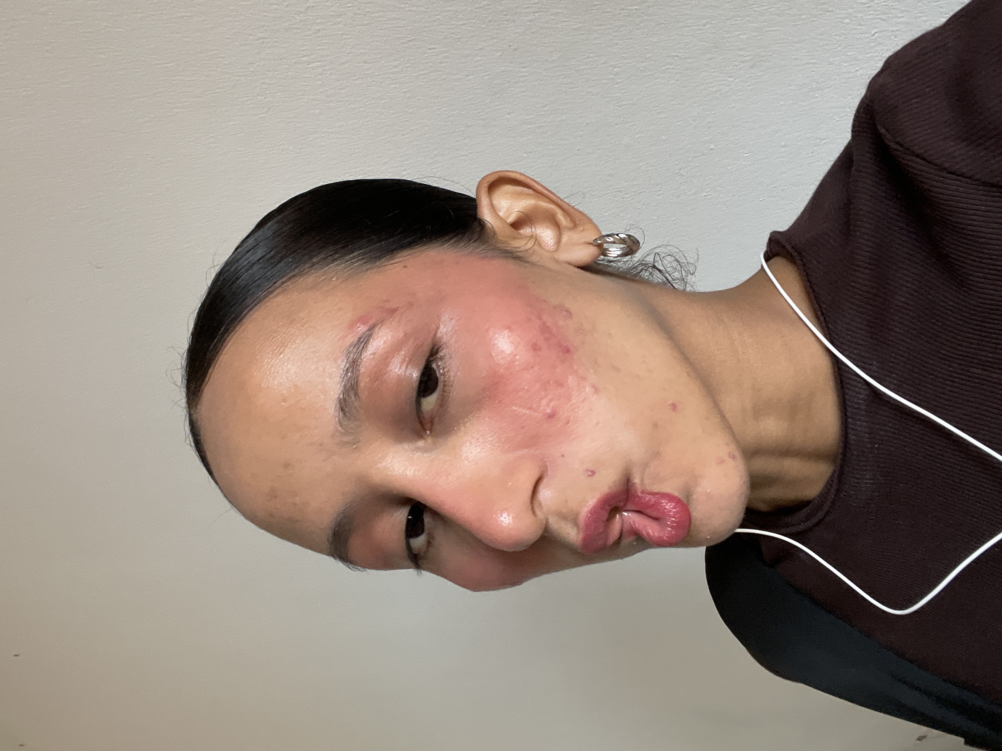 A profile view selfie of a person with dark hair pulled back into a bun, facing left. The person has prominent cheekbones and is making a puckered facial expression with their tongue slightly extended. Their skin appears to have redness and blemishes on the cheeks and forehead. They are wearing a dark brown ribbed top and a black jacket or garment over it. White earbuds are visible around their neck and chest. The background is a plain, light-colored wall. There is no discernible location in the city of Porlamar, Venezuela.