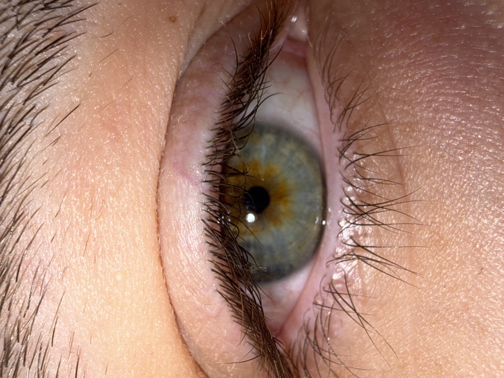 A close-up photograph shows a human eye. The iris is a mix of green and gold, with a dark pupil in the center. Eyelashes are visible along the top and bottom eyelids. Skin texture is prominent around the eye. There is no indication of a specific location in Stara Zagora, Bulgaria.