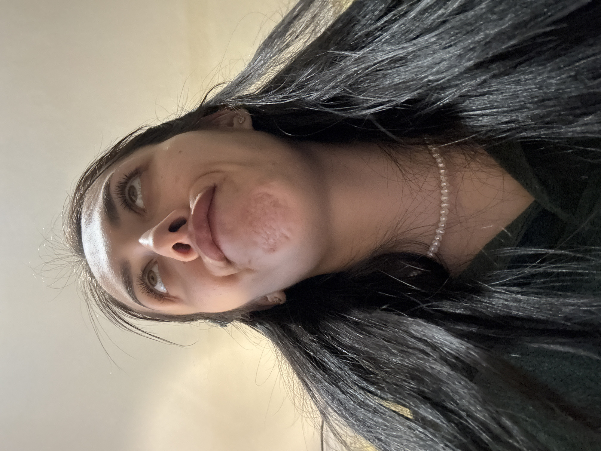 A portrait-style photograph, taken from a low-angle perspective, features a young person, likely female, with long, dark, slightly wavy hair. The image is oriented with the subject's head tilted, looking upwards and slightly towards the camera. She has light brown or hazel eyes with visible mascara on her lashes, and well-defined eyebrows. Her lips are slightly parted or pursed, giving a somewhat neutral or contemplative expression, possibly a faint smirk.
The subject is wearing a dark-colored top, possibly green, and a delicate pearl-like beaded necklace is visible around her neck. Her long, black hair frames her face and extends out of the frame. Notable skin texture and some raised areas are visible on her left cheek/jawline (viewer's right). The background is a plain, light-colored (beige or off-white) surface, suggesting an indoor setting. The lighting appears soft and even. No specific activity is taking place beyond posing for the photograph, possibly a selfie. There is no visible text. The location context indicates this indoor scene is in Votkinsk, Russia.