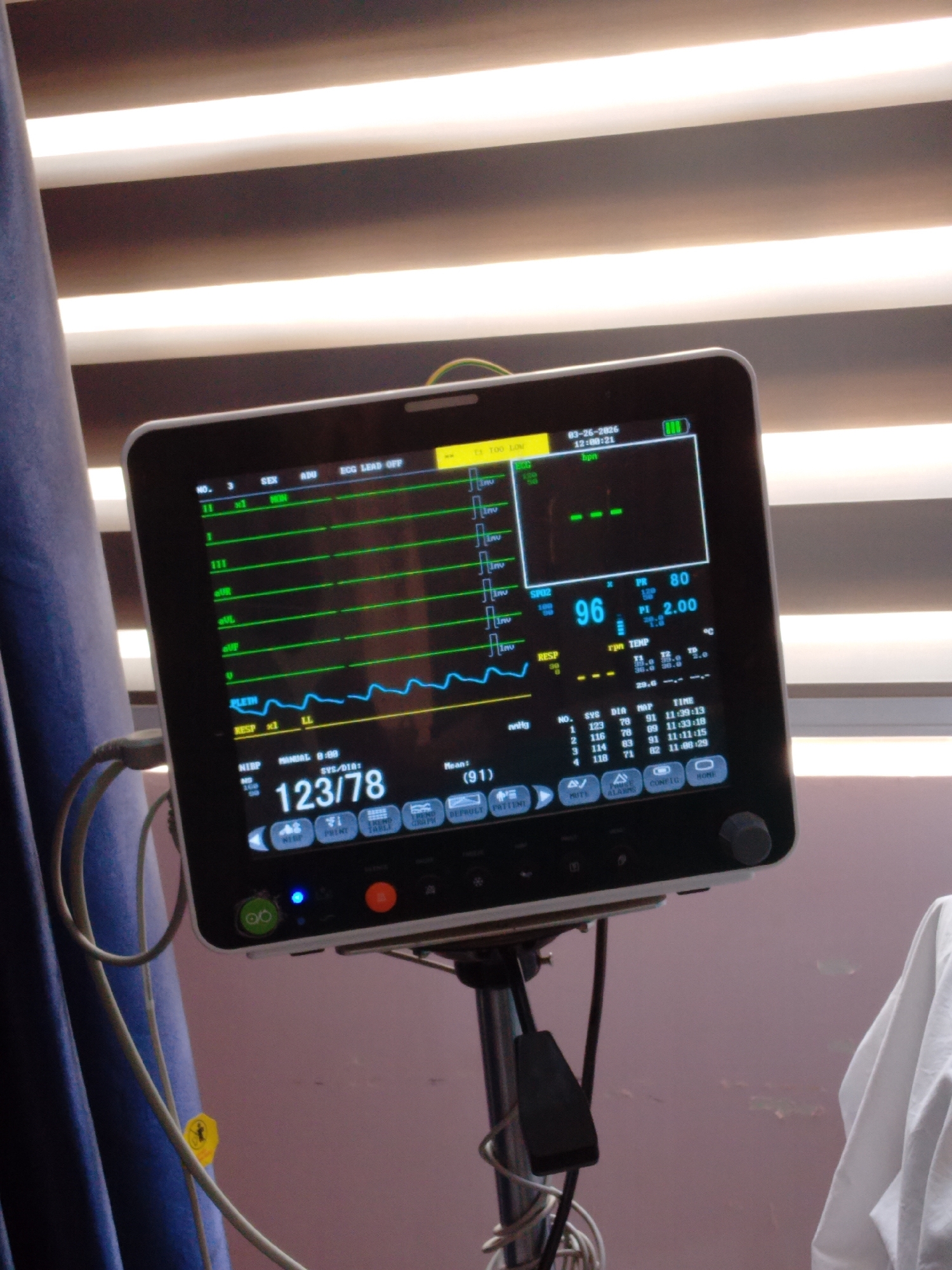 The image depicts a medical patient monitor positioned within a healthcare environment in Sabon Tasha, Nigeria. The monitor's screen is illuminated, displaying various vital sign parameters. The date and time shown are 03-26-2026, 12:00:21. Key readings visible include SpO2 at 96%, Pulse Rate (PR) at 80 bpm, and Non-Invasive Blood Pressure (NIBP) Systemic/Diastolic at 123/78 mmHg, with a Mean Arterial Pressure of 91 mmHg. A prominent notification "ECG LEAD OFF" indicates that the electrocardiogram leads are not connected or are detached. Respiration (RESP) parameters are present, as is Perfusion Index (PI) at 2.00. Temperature readings are displayed as T1 35.0 and T2 35.0 degrees Celsius, with a delta temperature (TD) of 0.0. The monitor is mounted on a metallic pole stand, with various grey medical cables extending from its left side, one featuring a small yellow circular tag. In the background, to the left of the monitor, a blue medical curtain is visible. To the right, white fabric, likely part of a bedsheet or medical gown, is present. Above the monitor, horizontal striped blinds with bright light filtering through them suggest a window or overhead lighting. The wall behind the white fabric appears to be a muted reddish-brown or pinkish-brown color. No individuals are present in the scene.
