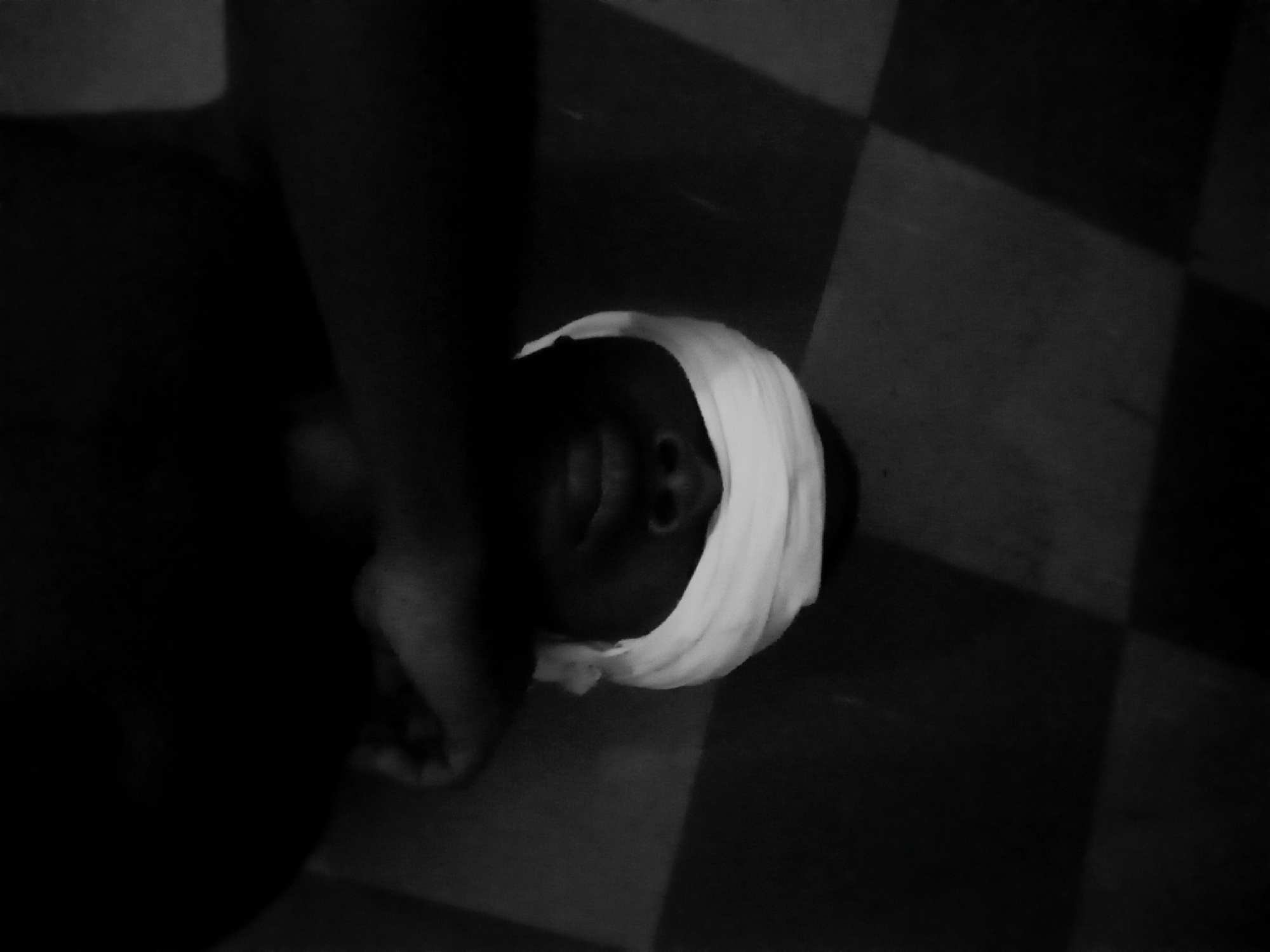 The image is a black and white photograph of a person lying on a checkered floor. The person has a white bandage wrapped around their head, covering their eyes. The person's face and lips are visible. An arm is resting across their body. The image does not confirm its location in Nkpor, Nigeria.
