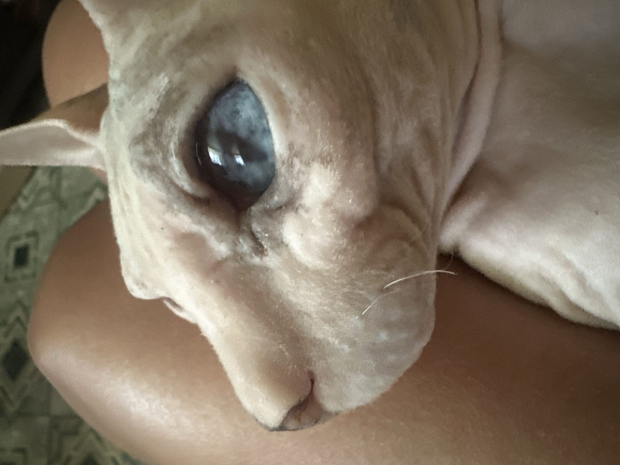 The close-up image shows a Sphynx cat's face, with its skin appearing pale and wrinkled. The cat's left eye is open and has a milky, clouded appearance, suggesting a potential medical condition. The iris is visible but obscured by the cloudy lens. The cat's nose is small and dark, with a hint of its mouth visible below. A single white whisker extends from the cat's cheek. The cat is being held, with a person's arm and shoulder visible in the foreground and background, supporting the cat's head and body. The person's skin tone is light. In the background, a patterned fabric, possibly upholstery or a blanket, is visible, featuring a geometric design of green and black diamonds on a lighter background. The lighting suggests it could be daytime, with natural light illuminating the scene. The overall mood is intimate, focusing on the cat's delicate features and the bond between the cat and its owner. There is no visible text in the image.