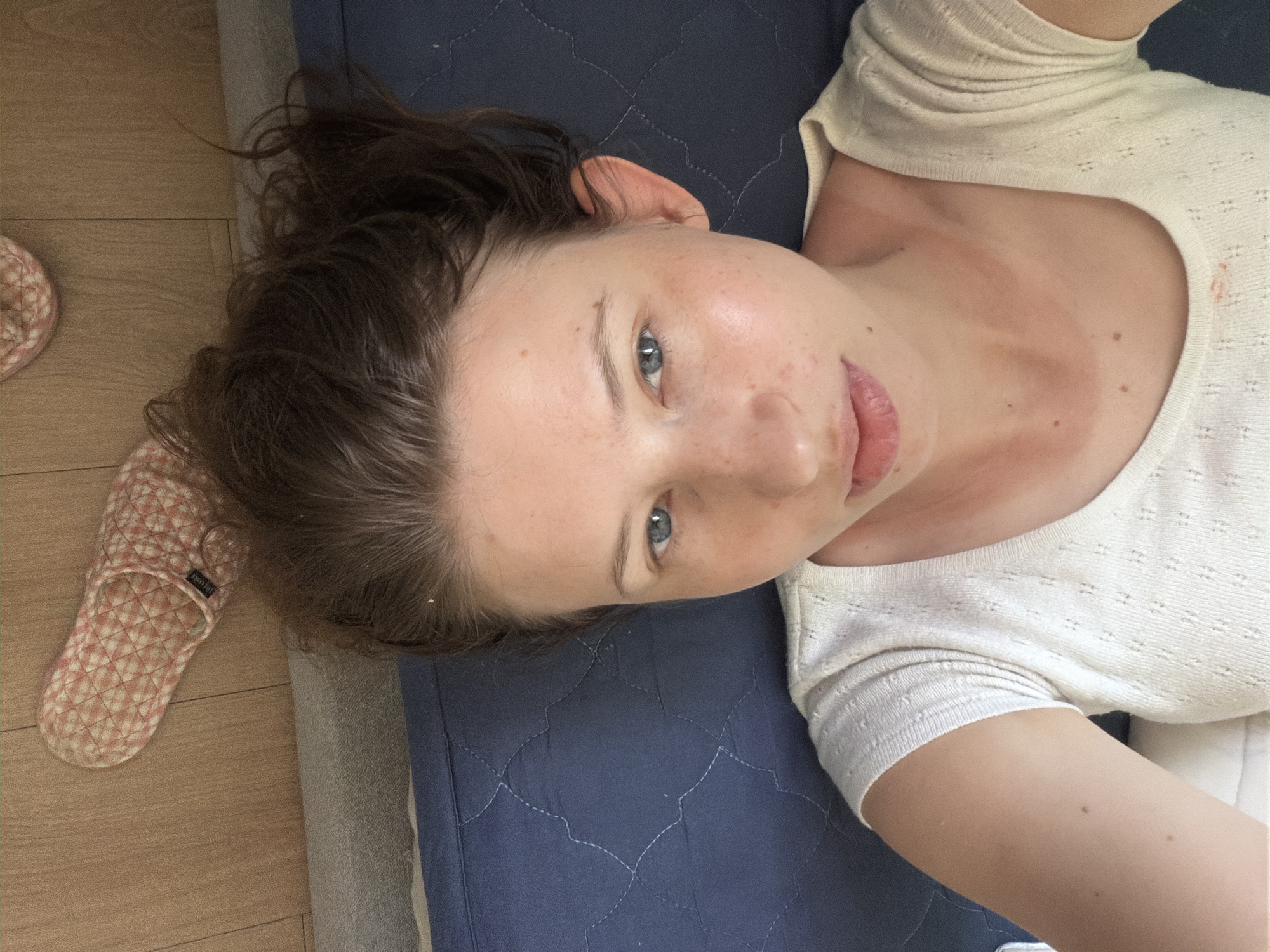 The image shows a young woman lying on her back on a blue quilted surface, likely a bed or mat. Her head is at the bottom of the frame, and she is looking upwards towards the camera. She is wearing a white knitted top with a patterned texture. Her hair is dark brown and falls around her head. There is some redness or irritation on her neck and chest, visible through the neckline of her top. Her face is tilted, with her eyes open and looking directly at the camera. Her lips are slightly parted. The background consists of the blue surface and a wooden floor visible at the bottom of the frame, where a pink and white patterned slipper is placed. The scene appears to be indoors, possibly in a bedroom, and does not contain any specific landmarks or indicators to pinpoint the location within Dongducheon-si, South Korea.