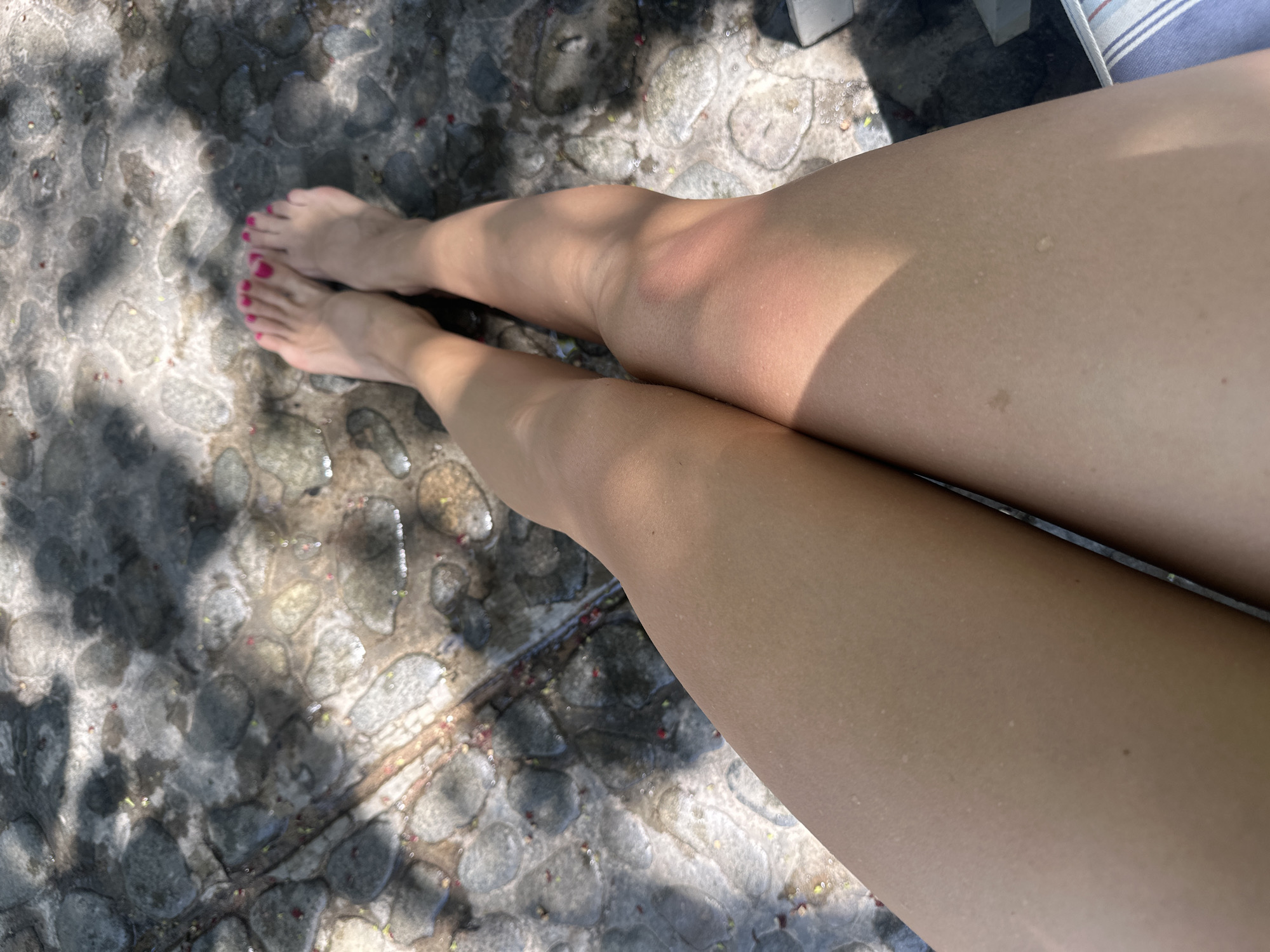 The image depicts a high-angle, downward view of the lower extremities of an individual, specifically two bare legs and feet, positioned on a wet, pebbled surface in Nha Trang Ward, Vietnam. The legs are extended away from the viewer, with the feet visible at the top of the frame. Both feet have toenails painted with bright pink polish. The skin on the legs appears tan, with numerous small water droplets visible, indicating recent exposure to moisture. The right leg, particularly around the knee, exhibits an area of increased redness. Partially visible at the bottom right corner is a blue and white striped fabric object, possibly a cushion or towel.
The ground surface consists of an irregular mosaic pattern of smooth, rounded stones or pebbles, predominantly dark grey to light grey in coloration. The stones and the spaces between them are wet, reflecting ambient light and showing small puddles. Scattered across the wet ground are sparse red and yellow specks, resembling fallen petals or small plant debris. Dappled sunlight illuminates the scene, casting distinct shadows of overhead foliage, such as leaves and branches, across the ground and portions of the legs.