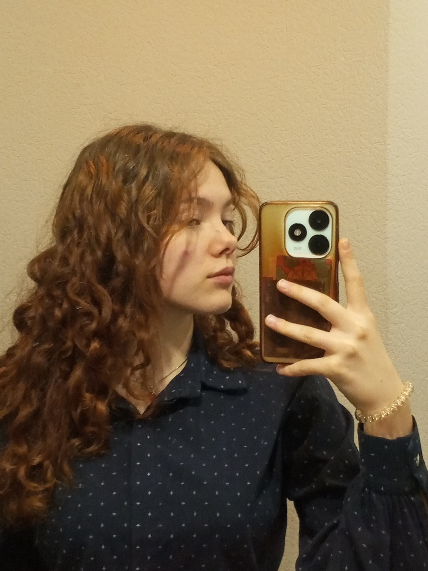 A young woman with auburn curly hair takes a selfie indoors. She is wearing a dark blue, long-sleeved blouse with small, white diamond-shaped patterns. A gold-toned bracelet adorns her right wrist. Her left cheek has a dark mark or discoloration. She holds a phone in a gold case in her right hand, positioned to capture her reflection. The background consists of a plain, light beige wall. It is impossible to tell if this photo was taken in Chaikovsky, Russia without additional information.