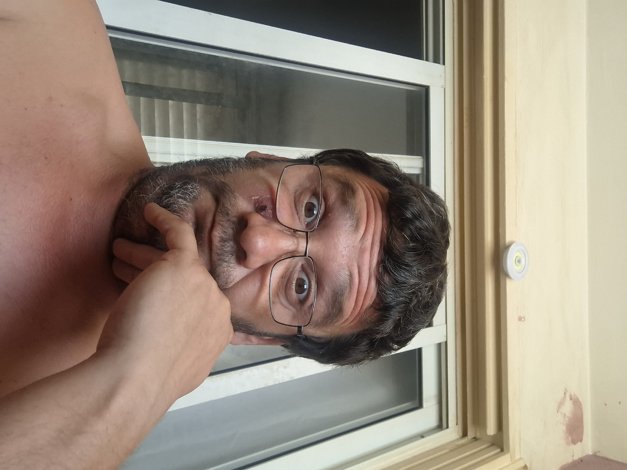 A close-up, selfie-style shot taken from a low angle captures a man's face and upper torso. He has brown, wavy hair, a beard with some graying, and is wearing glasses. There is a visible wound or abrasion on his cheek, below his right eye. The man's left hand is resting on his chin. He appears to be indoors, with a window or door with blinds behind him. The background includes a light-colored wall with some discoloration and a circular light fixture. The image is well-lit, suggesting it was taken during the day.