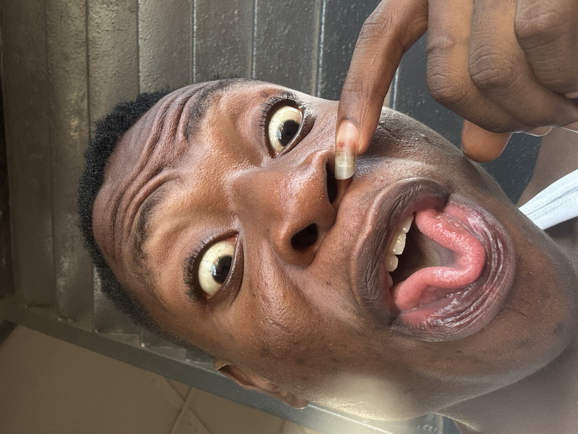 A close-up, rotated image shows a dark-skinned person looking up at the camera with a wide-eyed expression and their mouth open, tongue extended. A finger is pressed against their nose. The background is indistinct, appearing to be a wall with vertical lines. The location is unknown.