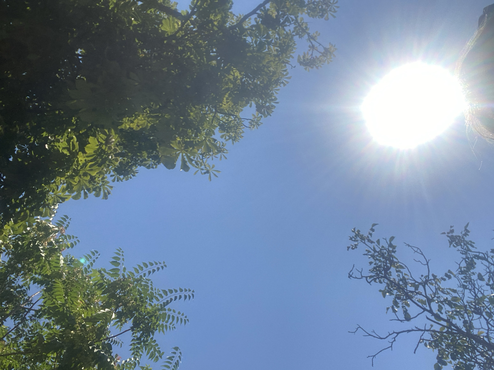 The image is an upward-facing shot of a bright blue sky partially obscured by tree branches with green leaves. The sun is intensely bright, positioned in the lower right quadrant of the image, creating a strong lens flare with visible rays. The top left and right corners of the image show dense foliage from two different types of trees. In the bottom left, a sparser tree with fewer leaves and bare branches is visible. At the very bottom center, the top of a person's head is visible, with hair reflecting the bright sunlight. The scene appears to be outdoors, likely in a park or a street lined with trees in the city of Chornomorsk, Ukraine.