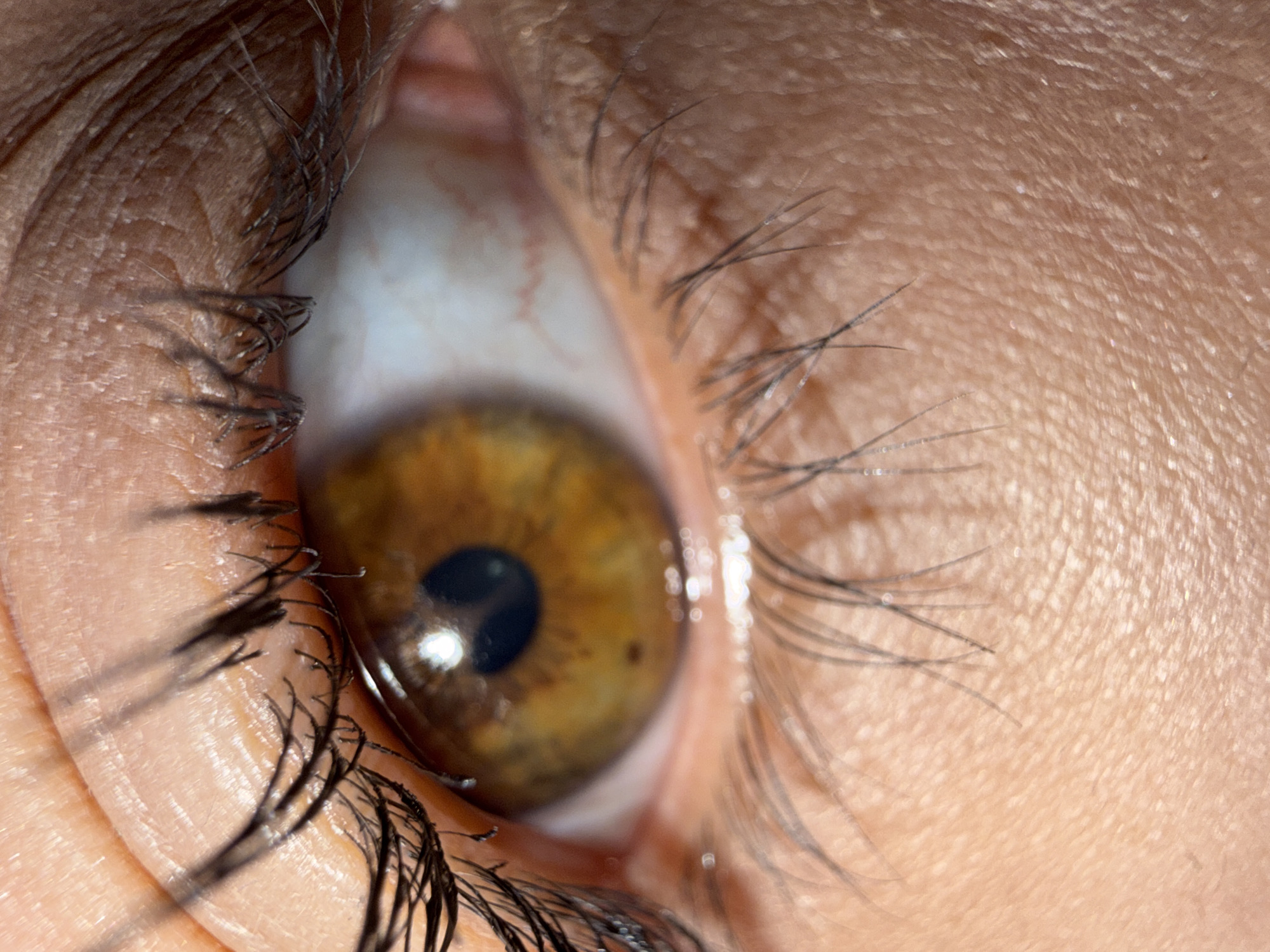 A close-up photograph captures a human eye with a brown iris. The pupil is black and reflects light. Eyelashes are visible along the upper and lower eyelids, some appearing to have mascara. The surrounding skin appears tan. The sclera (white part of the eye) is visible with some blood vessels. There is no indication of the location being Votkinsk, Russia or any other specific location.
