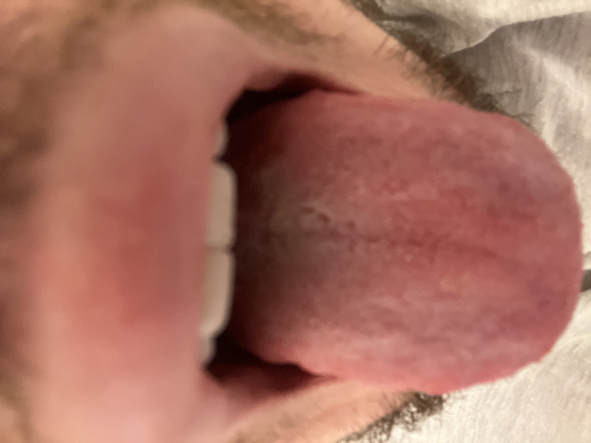 A close-up image shows a human mouth open with the tongue extended. The tongue appears slightly pale with a central groove. White teeth are visible. Some facial hair is present near the mouth. The background is a blurry, light-colored fabric. There is no indication of location in Varna, Bulgaria, or any other specific location.