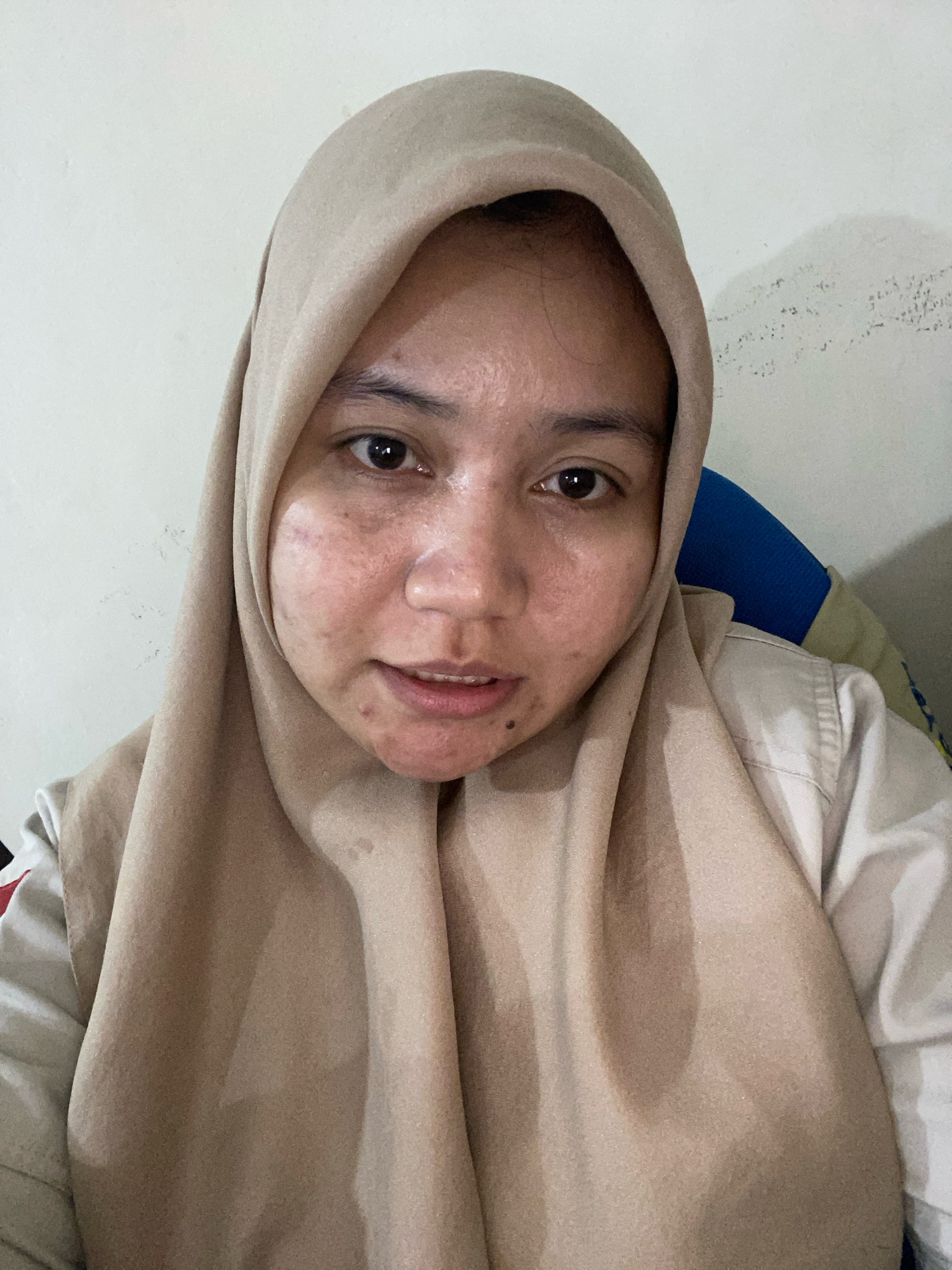This is a close-up, front-facing selfie of a young woman wearing a light brown hijab and a light-colored collared shirt. She is seated indoors, with a white wall and a blurred chair in the background. Her face is slightly angled towards the camera, and she appears to be looking directly at it. The lighting is soft, casting gentle shadows on her face and hijab. The image captures details of her skin texture, including some blemishes and marks, as well as her facial features such as her eyes, nose, and mouth. The overall impression is a casual, personal snapshot. The location is identified as Banjarbaru, Indonesia.