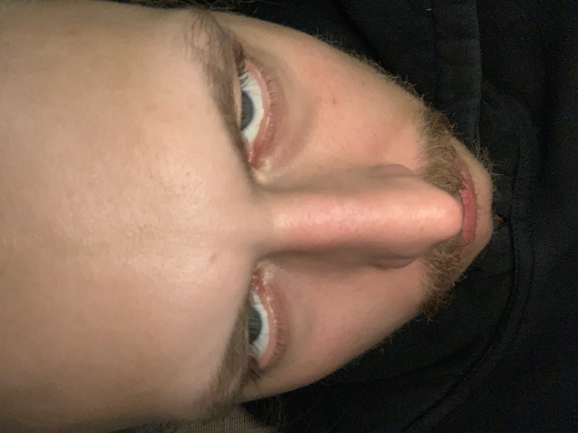 A close-up photograph features a person's face, viewed from a low angle. The individual has light skin, a prominent nose, and blue eyes. Short, light-brown facial hair is visible around the mouth and chin. The background consists of a dark, textured fabric, possibly clothing. The image does not contain enough information to determine a location in Tel-Aviv, Israel.