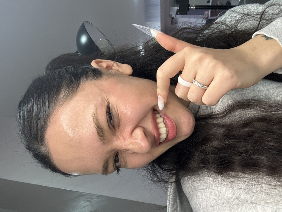 The image, rotated 90 degrees clockwise, presents a close-up portrait of a young woman from the chest up, set indoors. She has dark hair, styled away from her face, and a black, cat ear-shaped accessory or headphone is visible on her head.
The woman is captured mid-expression, smiling widely with her mouth open, revealing her white teeth and pink gums. Her eyes are squinted, and her nose is wrinkled, conveying a strong sense of humor, joy, or a playful grimace. She uses her right index finger to pull down her lower lip and cheek, further exposing her lower teeth. This finger features a long, sharply pointed artificial nail with a clear to white ombre design. On her right ring finger, she wears two rings: a prominent, matte white silicone band and a thinner, silver-toned ring embellished with a line of small, clear, rectangular stones. She is dressed in a light grey top or sweater.
The background is a simple, uniform light grey, indicating an uncluttered indoor space. No text is visible in the image. The overall atmosphere conveyed is one of candid playfulness and expressiveness. The location context for this scene is Yerevan, Armenia.