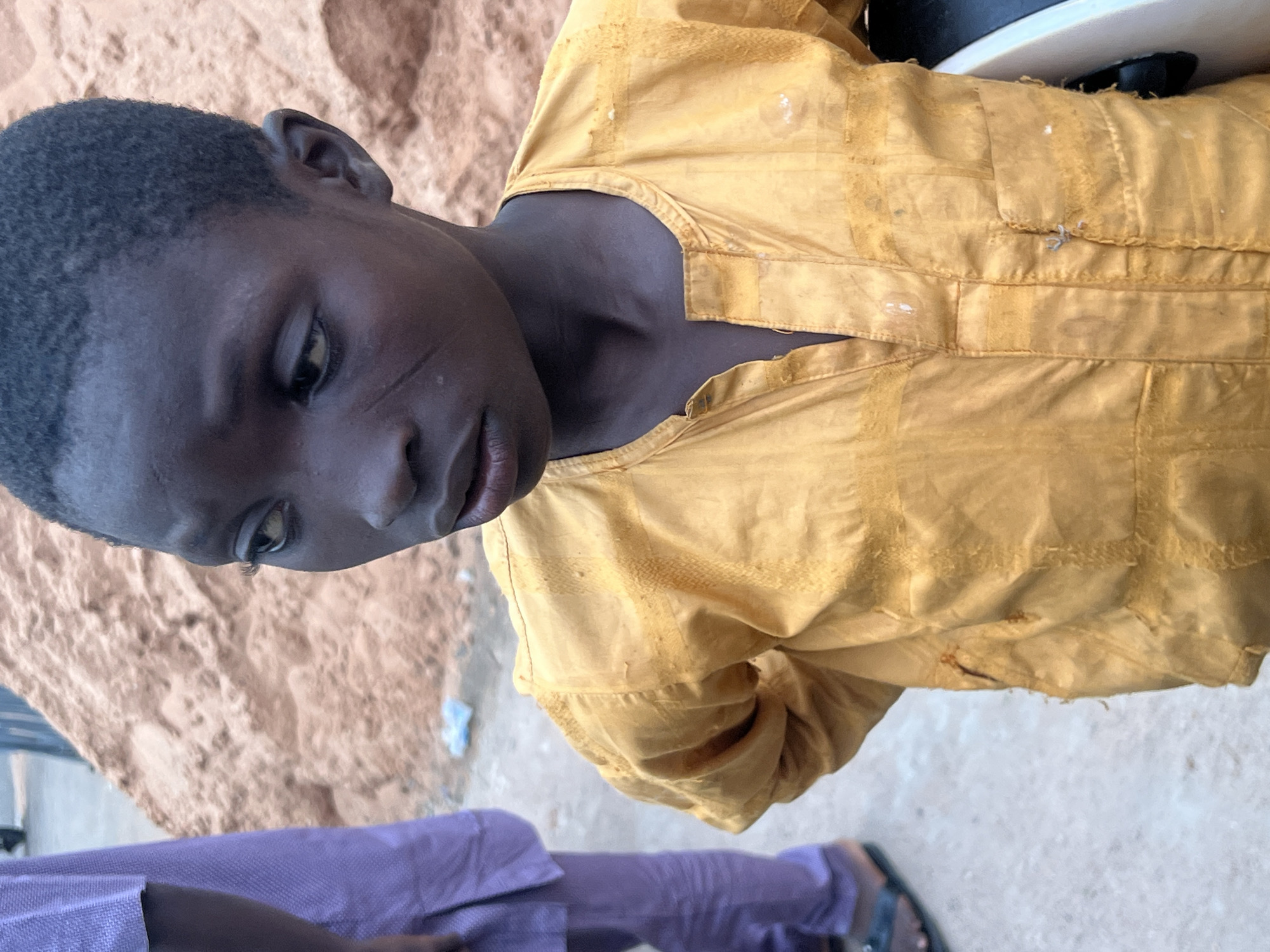 This media file shows a close-up, vertically oriented, eye-level view of a young person wearing a yellow, collared, long-sleeved garment. The garment appears to be made of a lightweight fabric and has a textured pattern woven into it. There are visible seams and some light-colored spots, possibly stains or paint, on the fabric. The person's face is visible, turned to the left, with dark skin and short, dark hair. A scar is visible on their cheek. The background consists of a sandy or dusty surface and hints of what might be a person in purple clothing in the lower part of the frame. The lighting suggests it might be daytime. The overall scene appears to be outdoors, possibly in an arid or dusty environment. There is no visible text in the image.
