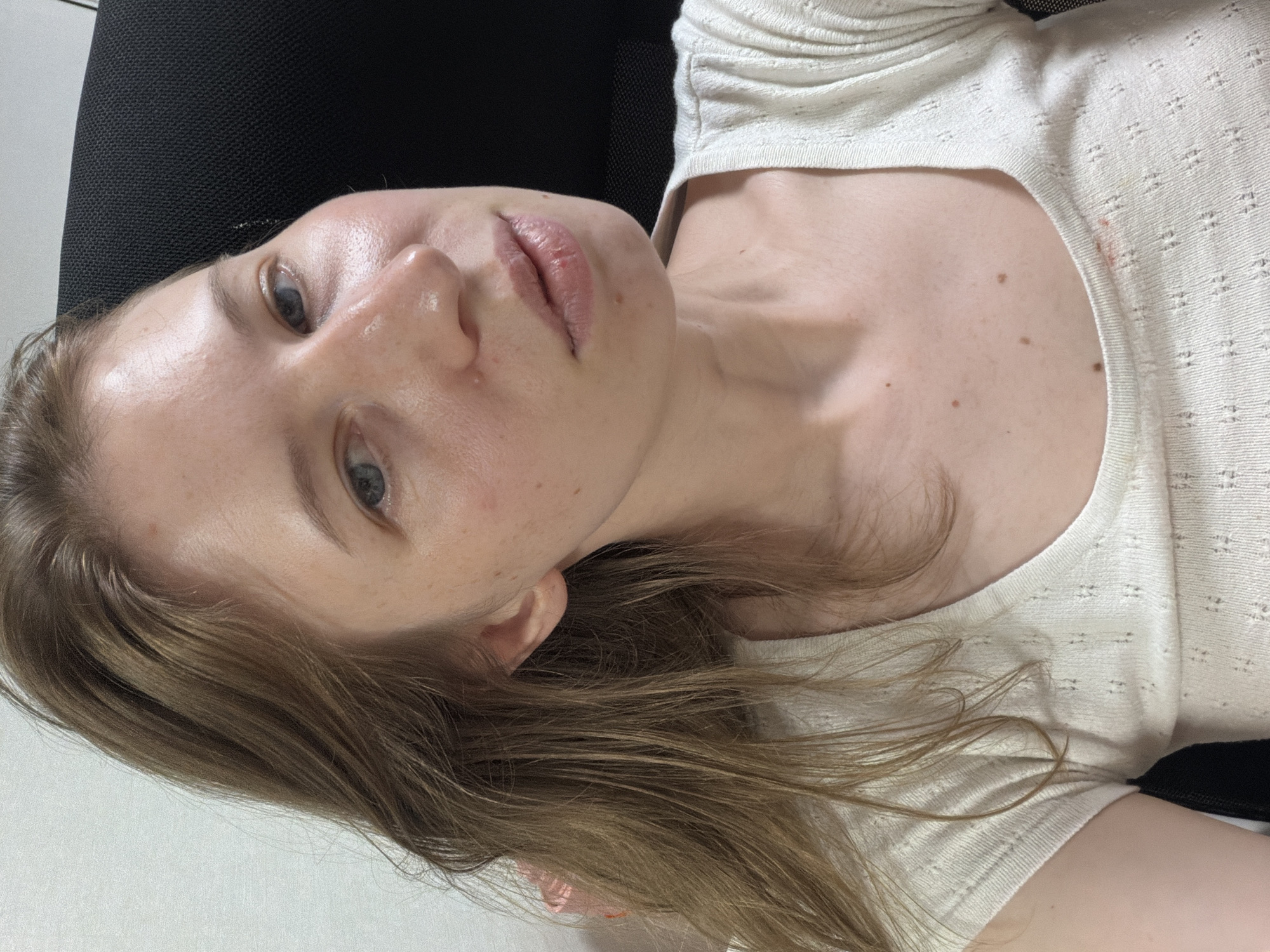 A medium shot shows a fair-skinned woman with shoulder-length light brown hair, looking slightly upward and to the right, with a neutral expression. She is wearing a light-colored, ribbed, scoop-neck top. Her skin appears to have some redness, particularly on her cheeks, and there are several small moles visible on her face and chest. The background is out of focus, with a plain wall to the left and a dark textured object, likely a chair, to the right. A small pink stain is visible on the woman's top near her collarbone. The scene appears to be indoors.