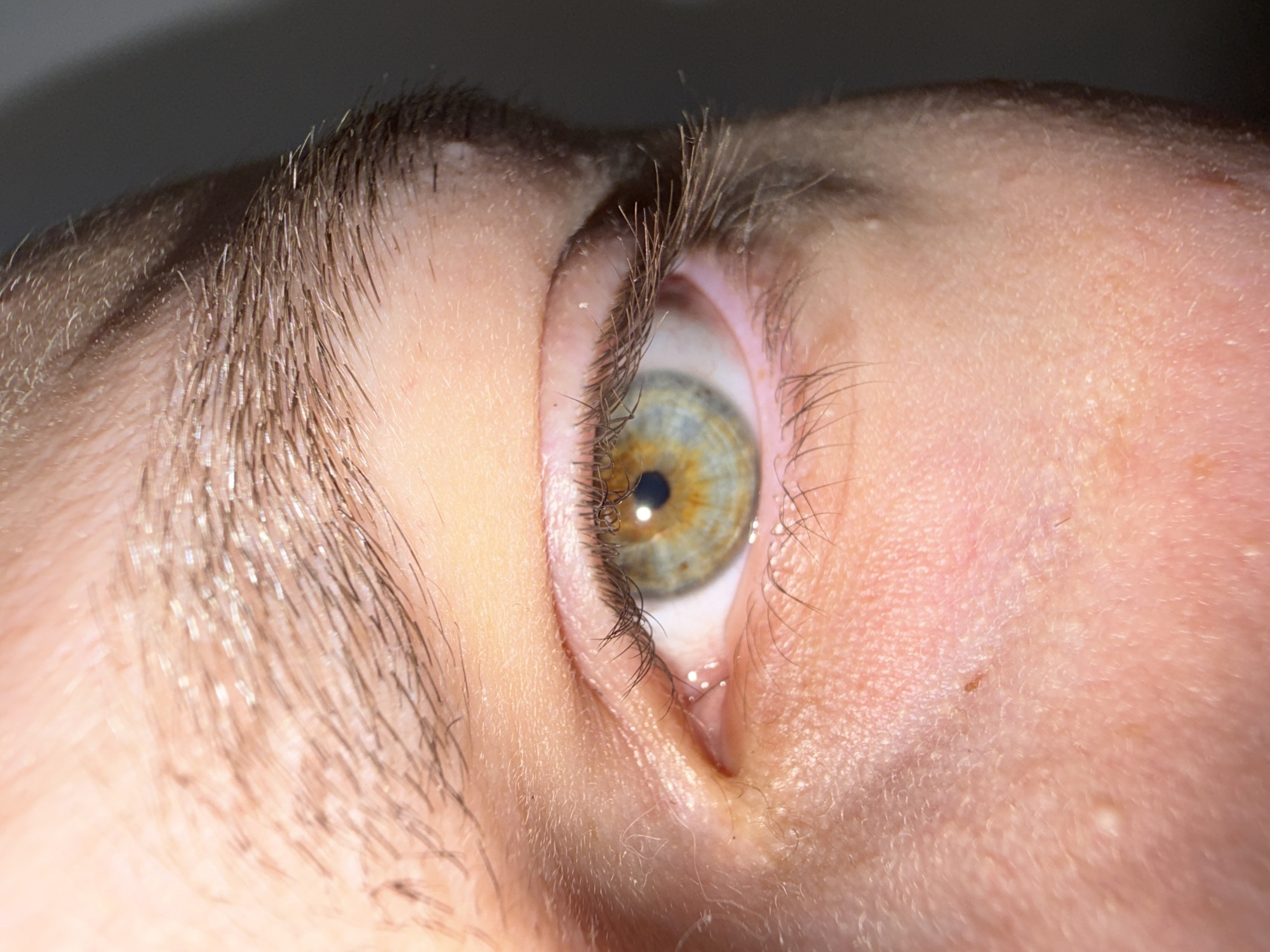 A close-up photograph depicts a person's eye, eyebrow, and surrounding skin. The eye has a multicolored iris with hues of green, blue, and yellow, centered around a dark pupil. The eyebrow is dark brown and extends to the left side of the frame. The skin around the eye is pale and displays visible pores and fine lines. The image does not depict a specific location in Stara Zagora, Bulgaria, or any other location. There are no actions, interactions, or other subjects and objects present.