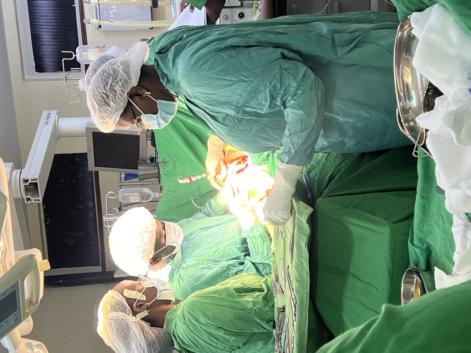 An operating room in Nairobi, Kenya, is depicted during an active surgical procedure. Four individuals are present, all wearing green surgical gowns, white bouffant caps, and face masks.
In the center-right foreground, a dark-skinned female, wearing glasses and a light blue surgical mask, is positioned with her gloved hands actively engaged at the patient's incision site. To her left, a dark-skinned male, also wearing glasses, a mask, and gloves, leans over the surgical field, participating in the procedure. Further left, a third dark-skinned individual, similarly attired, observes the activity. The fourth individual, partially visible on the far right, holds a clipboard or chart.
The patient is mostly obscured by green surgical drapes, with a brightly illuminated surgical field revealing exposed tissue and blood, indicating an ongoing incision. A specific surgical instrument, possibly an electrocautery pen, is visible in the hands of one surgeon, directed at the incision.
The environment features multiple overhead surgical lights, one with a visible "KLS Martin" brand label. In the background, an IV pole holds two hanging intravenous fluid bags, alongside a medical monitor screen and a wall-mounted light panel. A table in the foreground holds an array of stainless steel surgical instruments, including clamps and forceps, laid out on a sterile green drape. Metal basins and white surgical gauze are also visible on nearby surfaces. The overall scene is brightly lit and sterile.