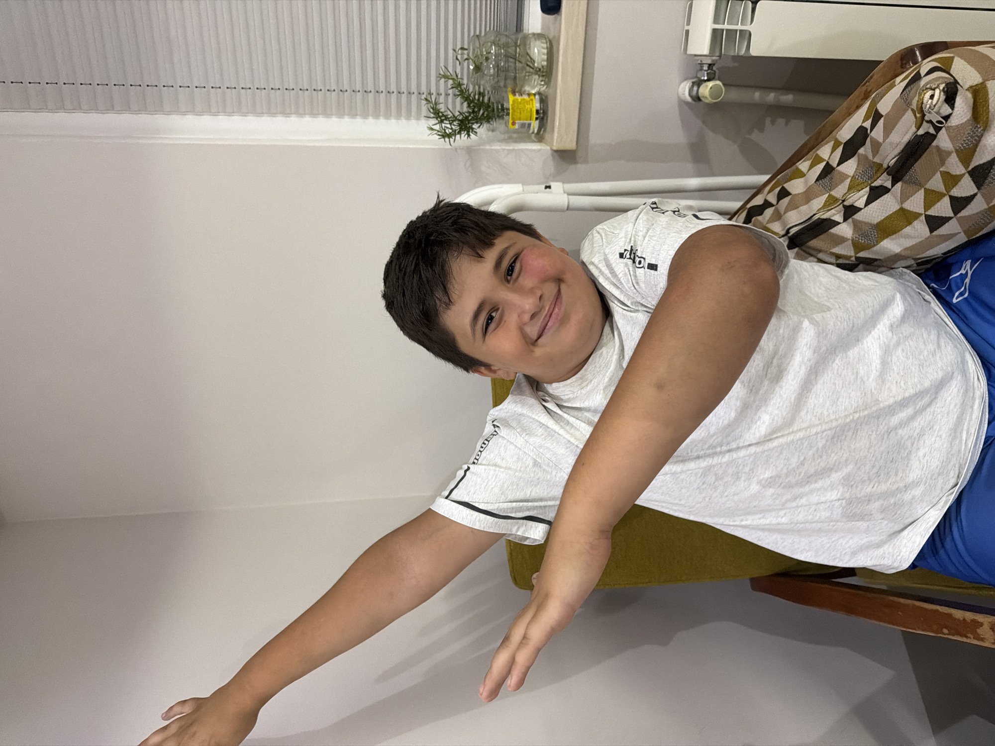 A young boy with dark hair and a light gray t-shirt with black stripes on the sleeves is sitting in a chair and dabbing. He has a red mark on his right cheek. The boy is in a room with a light-colored wall and a radiator. There is a window with blinds in the background. The chair has a wooden frame and a green cushion. A patterned pillow is on the chair next to the boy. This image was taken in Sabunchu Raion, Azerbaijan.