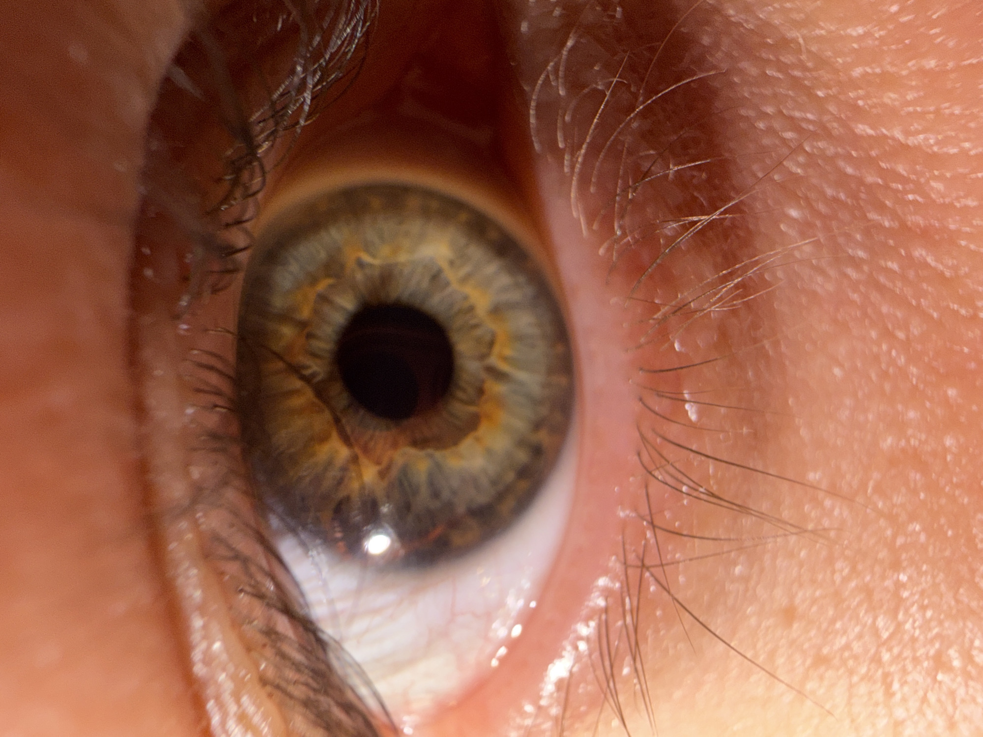 The image is an extreme close-up of a human eye, showing the iris, pupil, eyelashes, and surrounding skin. The iris exhibits a heterochromic pattern with shades of green, brown, and gold. The skin shows pores and fine hairs. There is no discernible location in Bangkok, Thailand, or any indication of environmental context. The image focuses solely on the biological details of the eye.