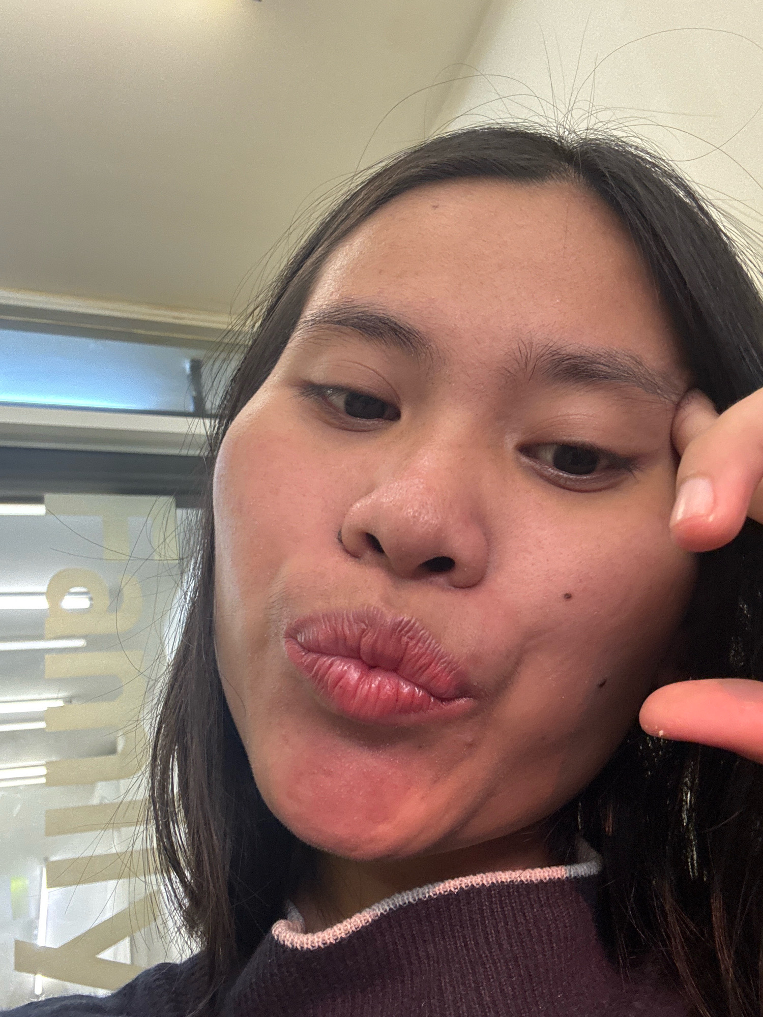 The image is a close-up, indoor selfie of a young East Asian female with dark hair. She is making a kissing face, puckering her lips and tilting her head slightly. Her right hand is resting on her forehead, and her left hand is visible near her chin. She is wearing a dark sweater with a pink and white striped trim. The background appears to be a room with a window or glass partition, possibly in an office or commercial setting, with horizontal blinds or light fixtures visible. The lighting is artificial and somewhat harsh. There is a dark mole on her right cheek and another on her jawline. The overall impression is casual and playful.
