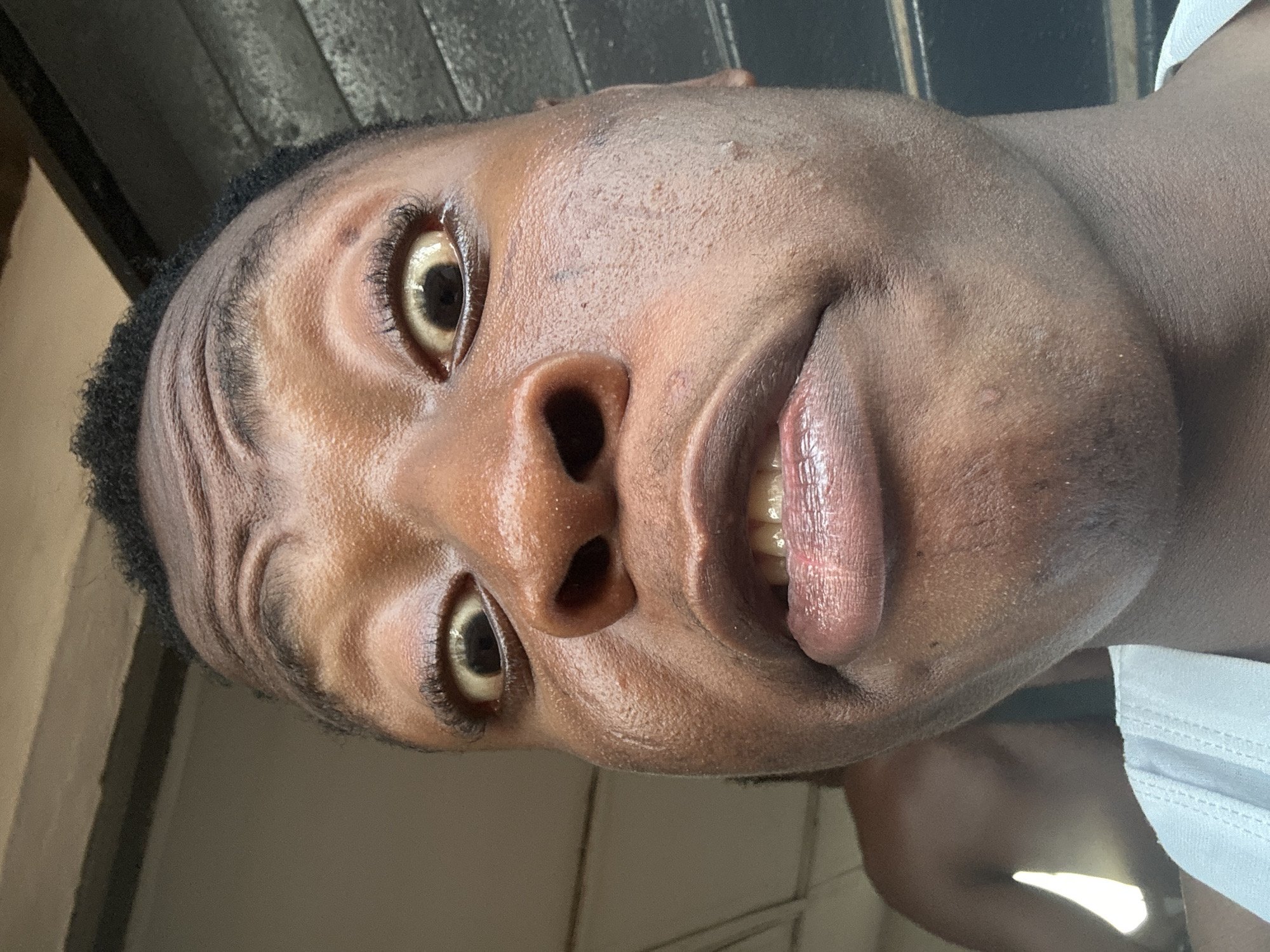 A close-up portrait of a dark-skinned person, likely male, with their head tilted slightly. The person is looking directly at the camera with their mouth partially open, revealing their teeth. The individual has short, dark hair. Their skin appears to be somewhat shiny or oily. A white shirt is visible near the lower right of the frame. The location appears to be indoors, possibly near a window. The city and exact location are not discernible from the provided image.