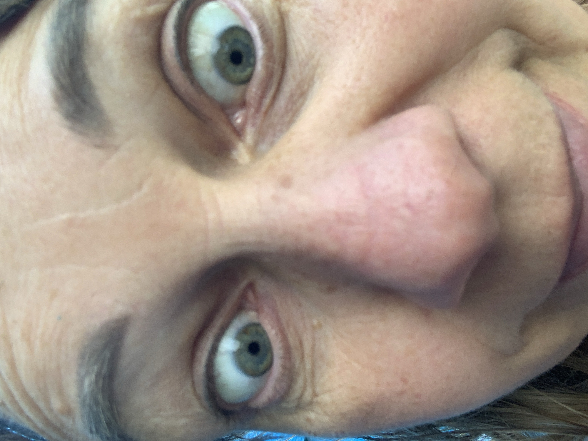 A close-up, eye-level, wide-angle selfie features a person's face filling the frame. The subject's eyes are wide open and looking directly at the camera. Their skin appears fair with visible pores and some fine wrinkles around the eyes. The lighting is bright, casting minimal shadows. The background is blurred, but a hint of blue suggests an outdoor environment. No specific location in Відзаўскі сельскі Савет, Belarus, can be determined from the image alone. The image captures a spontaneous and expressive facial moment.