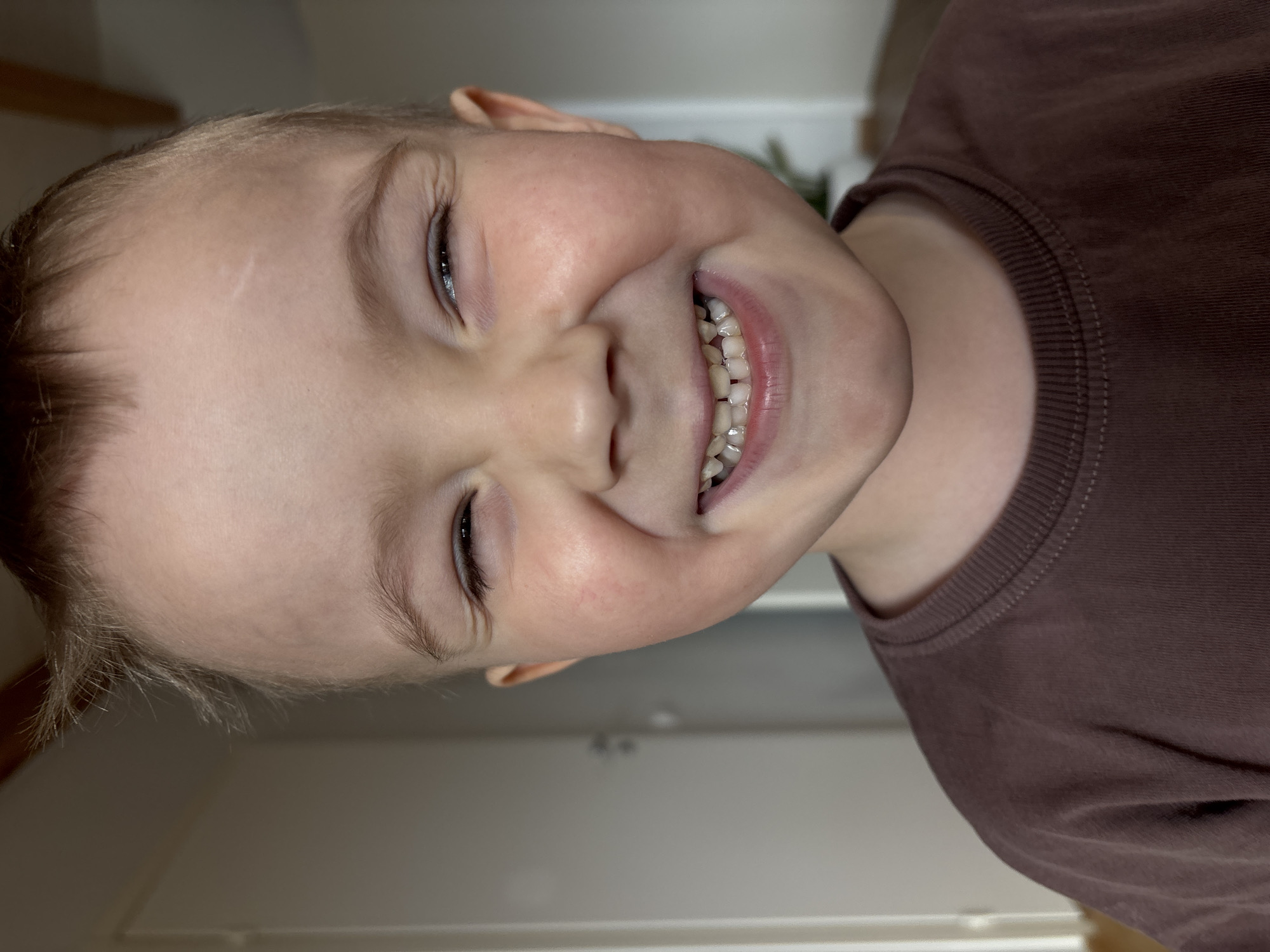 A close-up, angled portrait shows a young boy with blonde hair, fair skin, and a scar on his forehead, grinning widely and displaying his teeth. He is wearing a brown t-shirt. The background appears to be an interior setting with a white door and wall partially visible. The location is not discernible from the image.