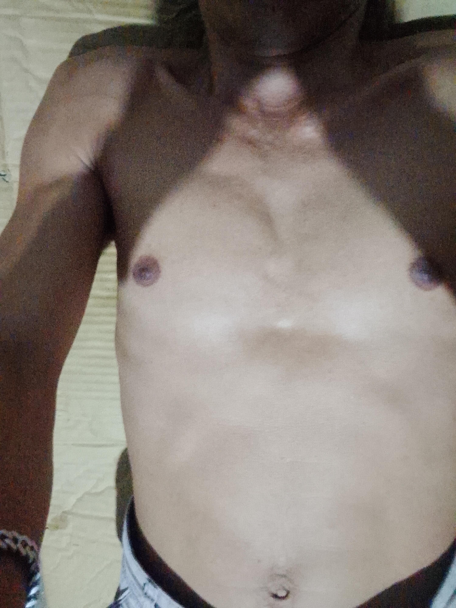 The image shows the torso and left arm of a shirtless person. The location of the image is not discernible and therefore cannot be located in Bukit Ketok, Indonesia. The person is lying on a surface, possibly a bed, with a patterned sheet underneath. The person has a light skin tone, visible nipples, and a navel. The left arm is flexed at the elbow. The person is wearing what appears to be a patterned garment at the waist. Shadow obscures parts of the image.