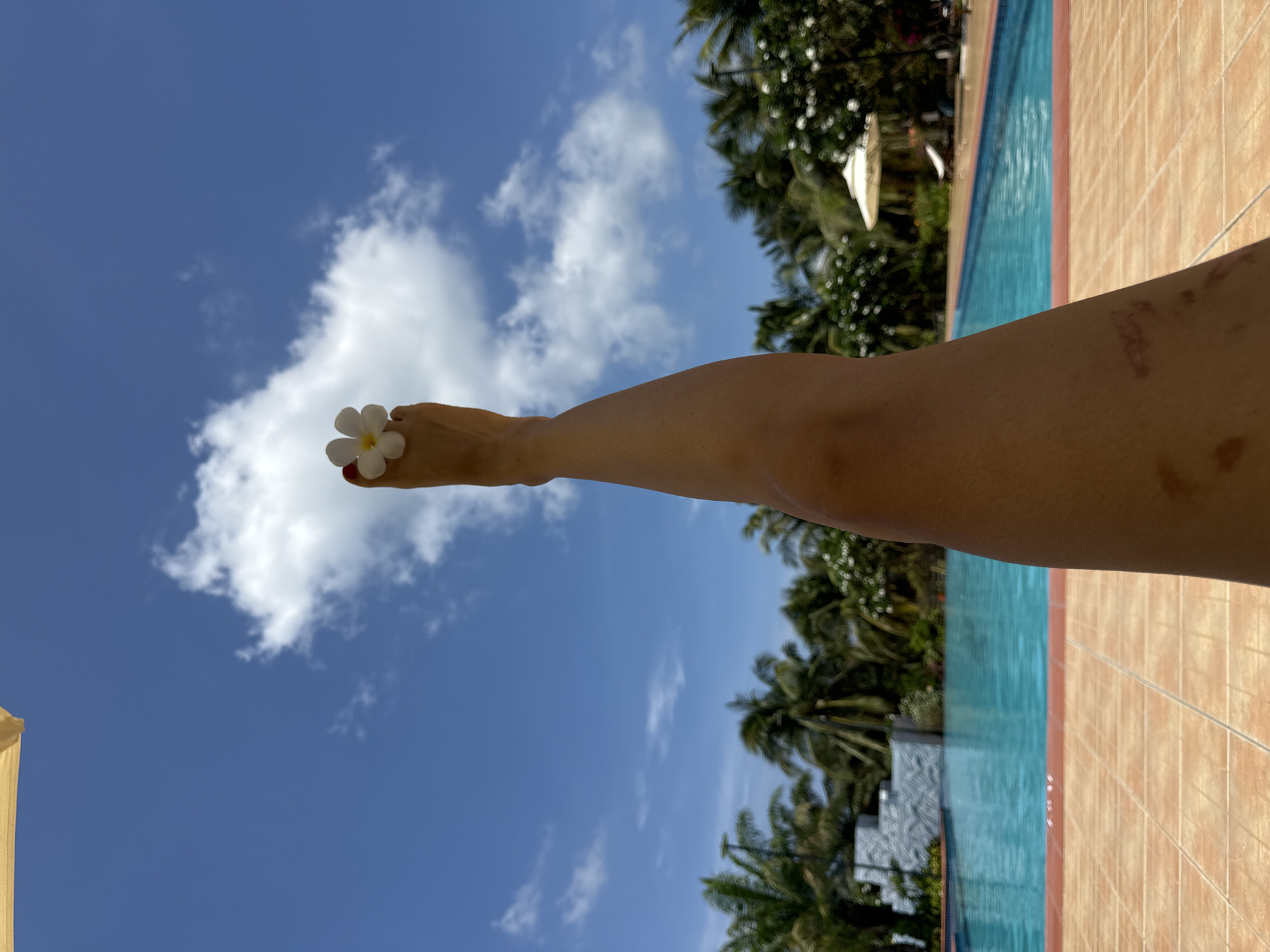 A human right leg, extending diagonally from the lower right to the upper center, is prominently featured against a bright blue sky with scattered white clouds. The skin on the leg appears tan, with several healed reddish-brown scars visible on the lower right calf. The foot, positioned upwards, displays toenails painted in alternating red and white polish. A white plumeria flower with a yellow center rests between the big toe and the second toe of the right foot.
Below the leg, a light blue swimming pool with a reddish-orange trim is visible. The pool is surrounded by light brown tiled paving. In the background, numerous lush green palm trees and other tropical foliage are present. A light-colored building or wall with textured relief is partially visible to the left of the pool. To the right, a white poolside umbrella and a white lounge chair are discernible amidst the greenery. The scene depicts a sunny outdoor environment, characteristic of a resort or leisure area in Phu Thuy Ward, Vietnam.