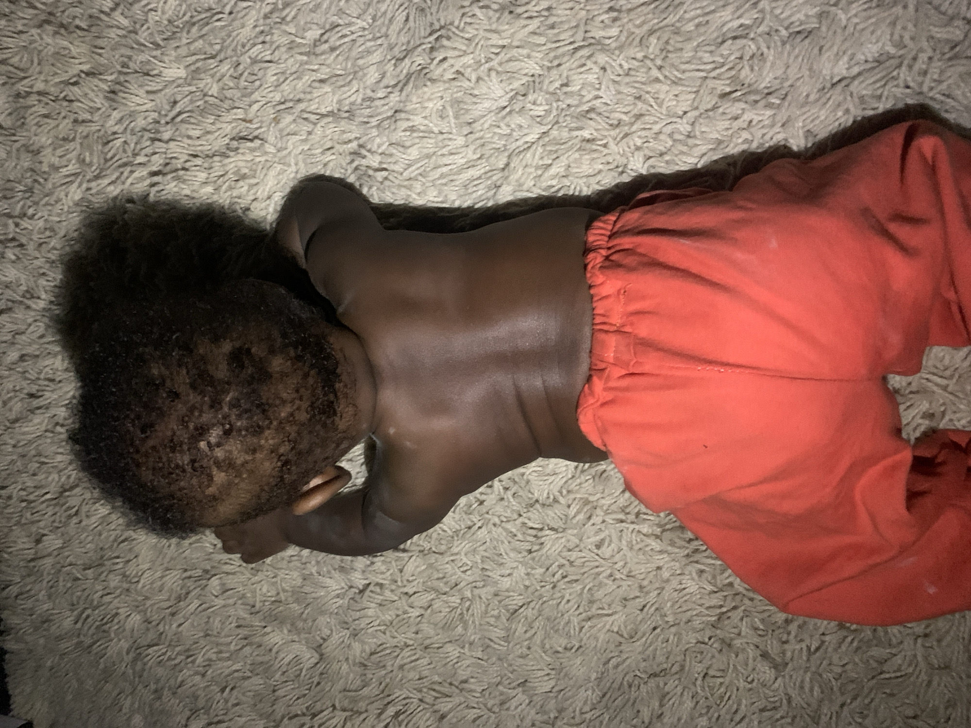 A baby is lying face down on a light-colored, shaggy rug. The baby has dark skin and curly, black hair. The baby is wearing orange pants. The location is not identifiable from the image and is therefore not able to be determined to be Barakin Akawo, Nigeria.