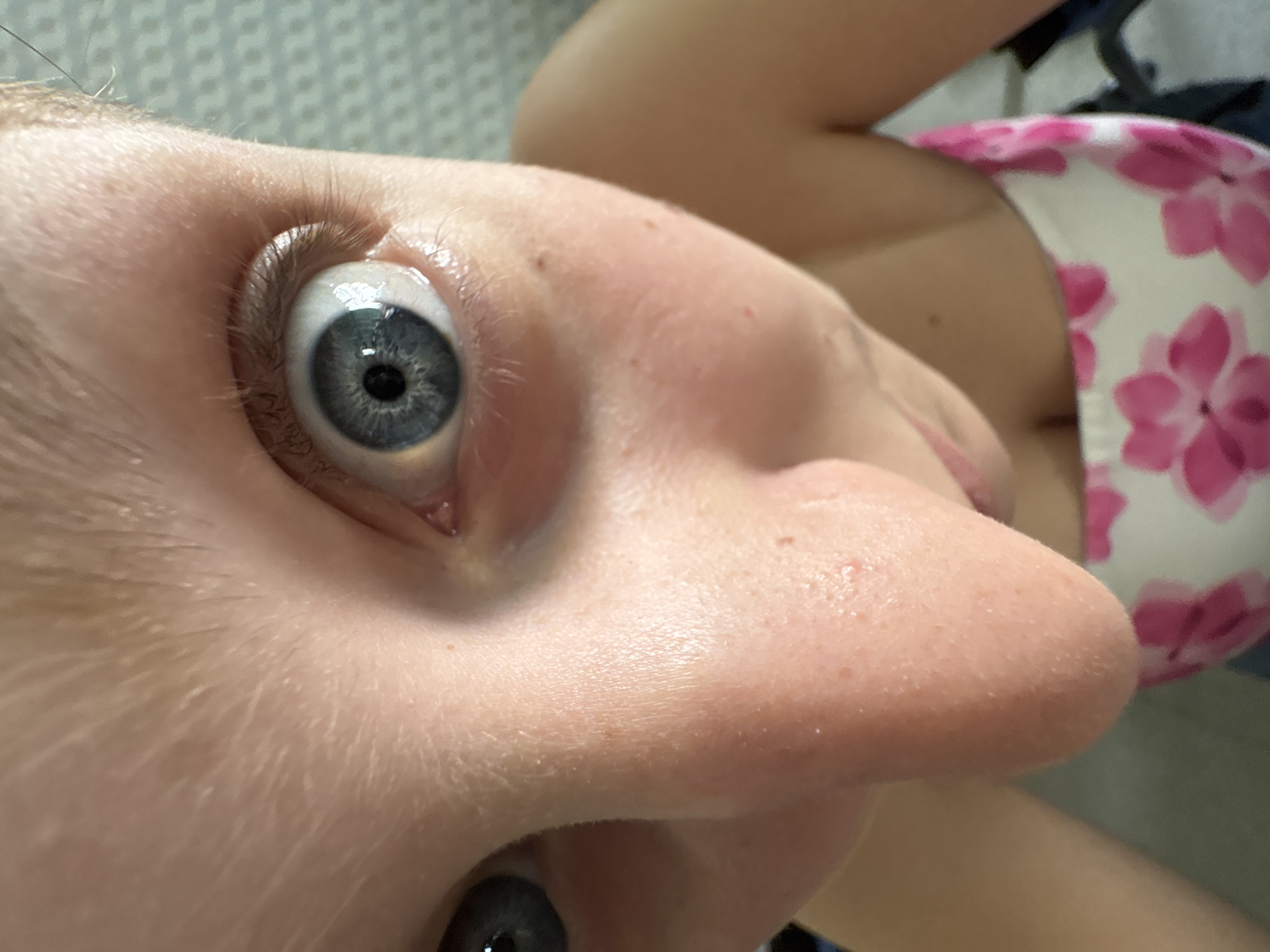 The image displays a highly unusual and extreme close-up perspective of a person's face, rotated approximately 90 degrees clockwise. The central focus is a wide-open left eye, featuring a prominent light blue-grey iris with a dark black pupil, reflecting indoor light. Eyelashes are clearly visible around the eye.
The skin around the eye, extending across the bridge of the nose, is highly detailed, showing visible pores, fine vellus hair (peach fuzz), and a few small red blemishes or freckles. The low and close-up camera angle makes the nose appear large and fills a significant portion of the lower right frame.
In the blurred background, to the right of the person's head, a white fabric with a distinct pink floral pattern is visible, suggestive of a swimsuit top or similar clothing item. Above this, a darker, indistinct fabric or surface can be seen. To the upper left, behind the person's head, there is a light-colored, subtly patterned surface, possibly a tiled wall or textured wallpaper, indicating an indoor setting.
The expression conveyed by the wide-open eye is ambiguous, potentially suggesting surprise, intense focus, or a deliberate pose. No specific activity is identifiable. There is no visible text in the image. The exact time of day or specific details of the location beyond it being an interior in Burgas, Bulgaria, are not discernible.