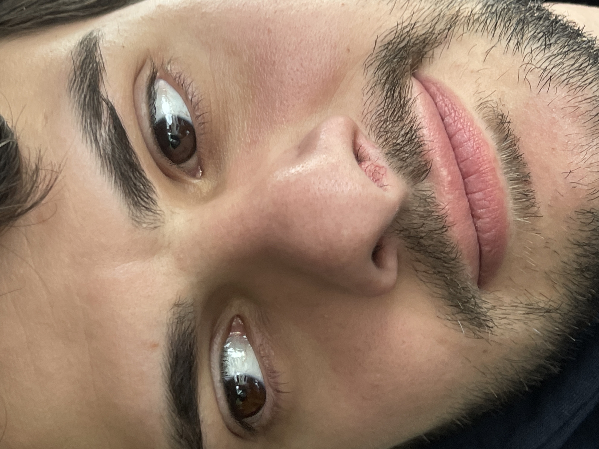 A close-up, slightly distorted perspective of a man's face. The face is oriented at an angle, with the left side of the face appearing higher than the right. The man has brown eyes, thick eyebrows, and a light beard and mustache. His skin tone is fair, and there are slight blemishes or redness on his cheek. The lighting suggests an indoor environment. There is no clear indication of the location being Tbilisi, Georgia, or any specific urban environment.