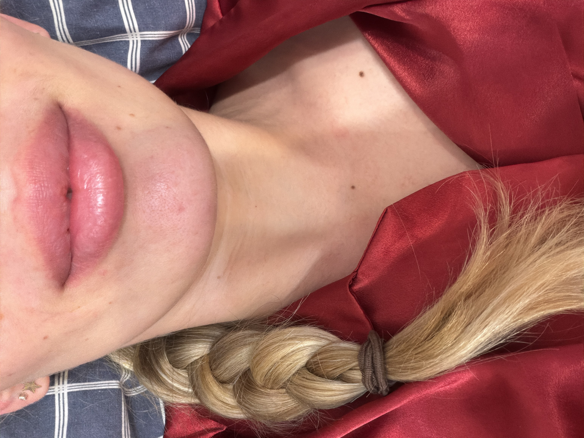 The image shows a close-up view of a person's face, neck, and part of their upper body. The person has fair skin and blond hair braided and secured with a brown hair tie. The lips are prominent and appear slightly swollen. A red, shiny fabric, possibly a robe or garment, drapes around the neck and shoulder area. The person is lying on a surface with a blue and white plaid pattern. No location information such as the city of Budva, Montenegro, is discernible from the image.