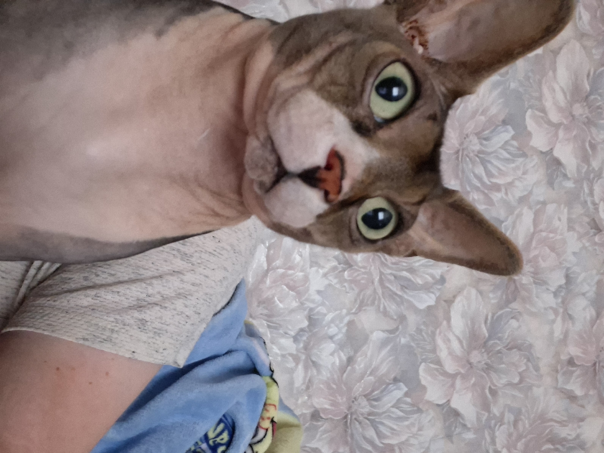 A Sphynx cat with green eyes looks directly at the viewer. The cat has large ears and a pinkish-red nose. It is lying on a floral-patterned surface, possibly a bedspread. A person's arm, wearing a light-colored t-shirt, is visible to the lower left of the cat, with a blue blanket near the arm. The location is not discernible from the image.