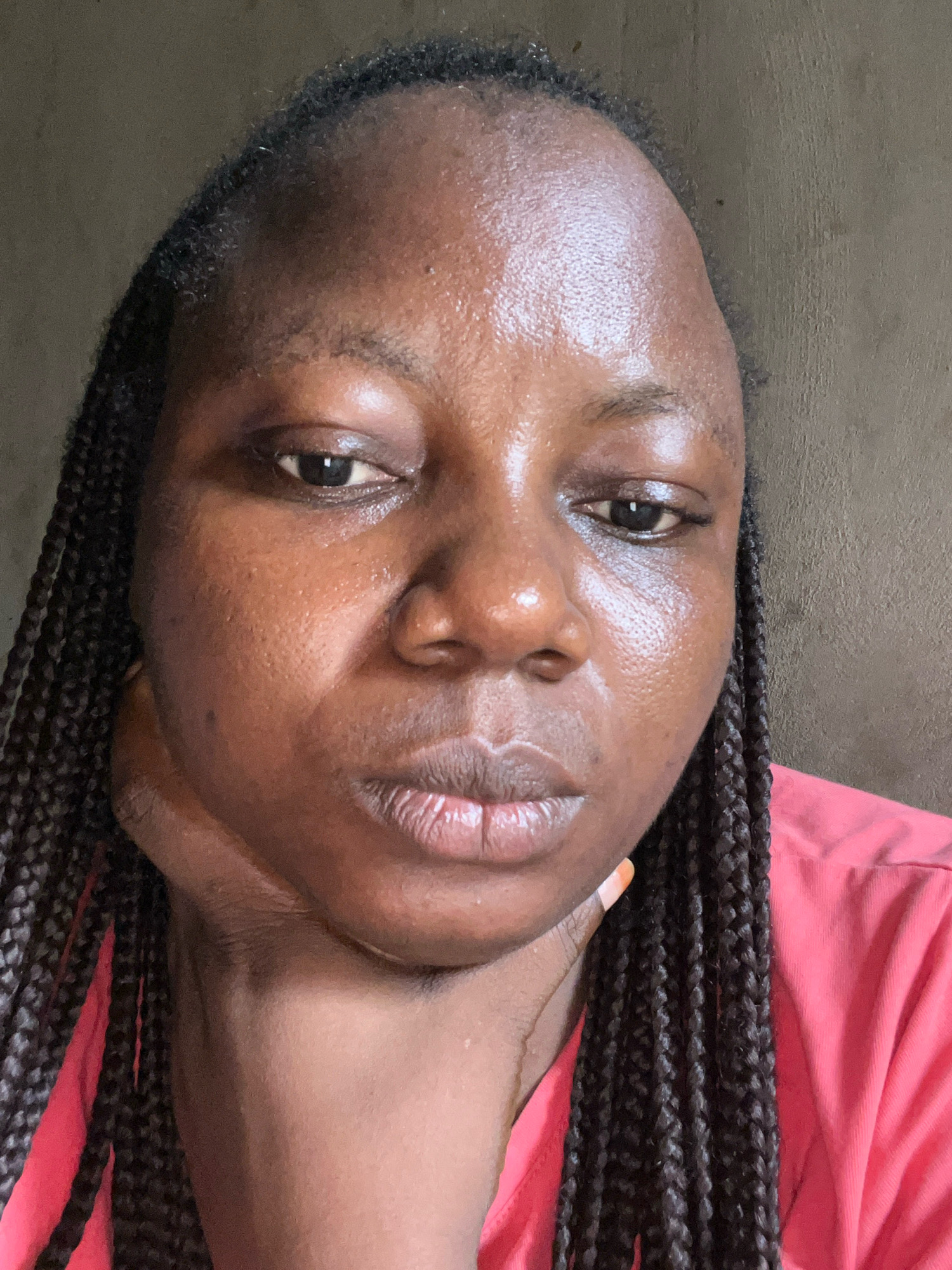 A close-up, eye-level selfie shows a Black woman with braided hair wearing a pink shirt. The woman's face is the primary focus, with her forehead, eyes, nose, and mouth clearly visible. Her skin appears to be moist or oily, and there is a noticeable swelling on the left side of her jawline. The background is a plain, textured wall with a brownish-gray hue. The lighting suggests an indoor setting, possibly a home environment in Ikotun, Nigeria.