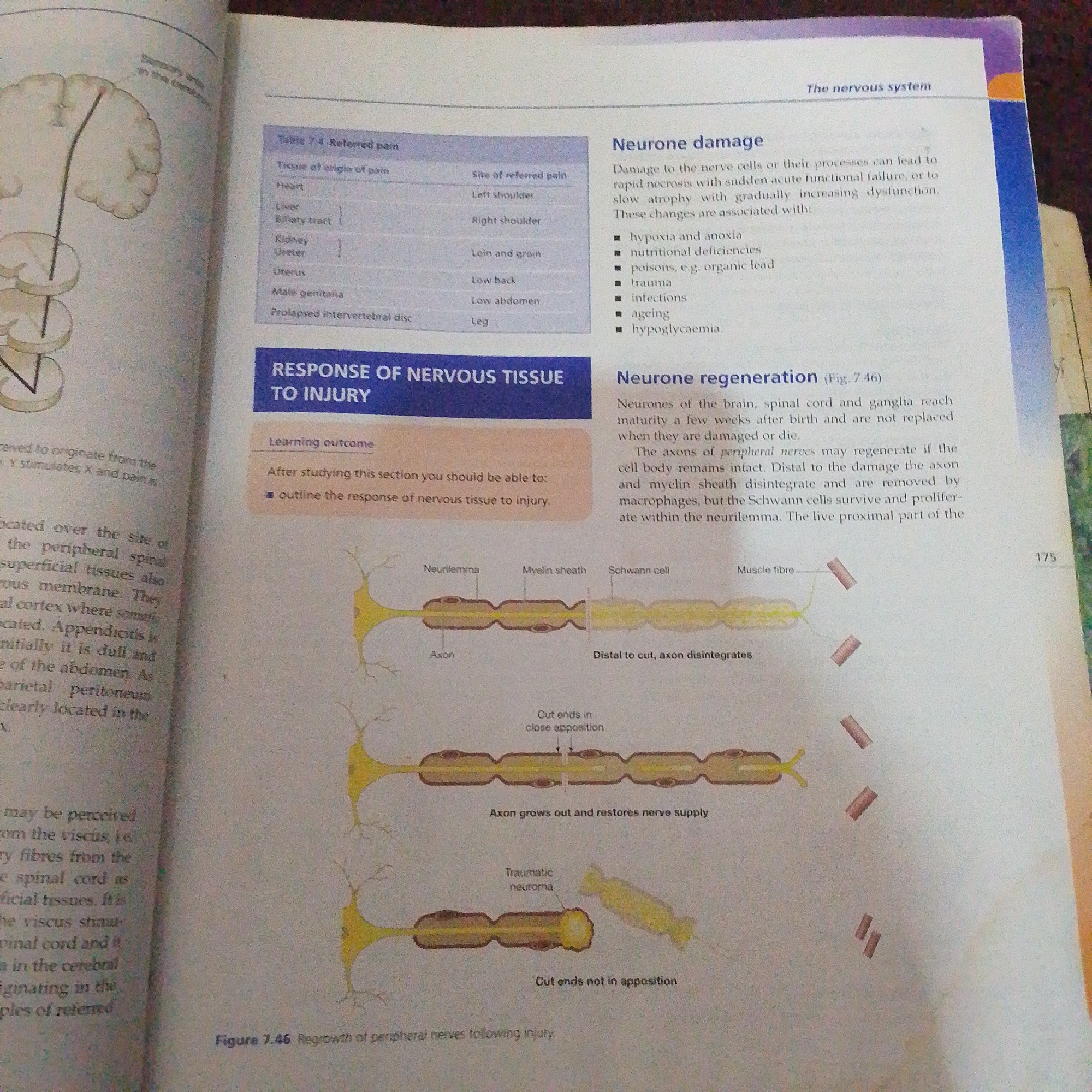 The image shows an open textbook page with diagrams and text related to the nervous system. The page is divided into two columns.
The left column features an illustration of the brain and spinal cord, with a diagram showing a nerve pathway originating from the brain and descending through the spinal cord. Below this, there is text discussing referred pain and its origins, with a table listing various tissues and their associated referred pain sites. Further down, the heading "RESPONSE OF NERVOUS TISSUE TO INJURY" is prominent, followed by a learning outcome statement.
The right column discusses "Neurone damage," detailing causes and effects of damage to nerve cells. It then introduces "Neurone regeneration," referencing Figure 7.46, which is illustrated below. This illustration depicts two scenarios of peripheral nerve injury: one where cut ends are in close apposition, allowing for axon regrowth and nerve supply restoration, and another where cut ends are not in apposition, leading to a traumatic neuroma. The diagram shows the components of a neuron, including the axon, myelin sheath, neurilemma, and Schwann cells.
The page is numbered "175" on the right side. The overall setting is that of an educational resource, likely a biology or anatomy textbook, intended to explain neurological concepts. There are no people or animals visible in the image, only printed text and diagrams. The lighting suggests an indoor environment, possibly a library or study area, with the page illuminated from above. The image quality is slightly blurred, typical of a photograph of a book page.
